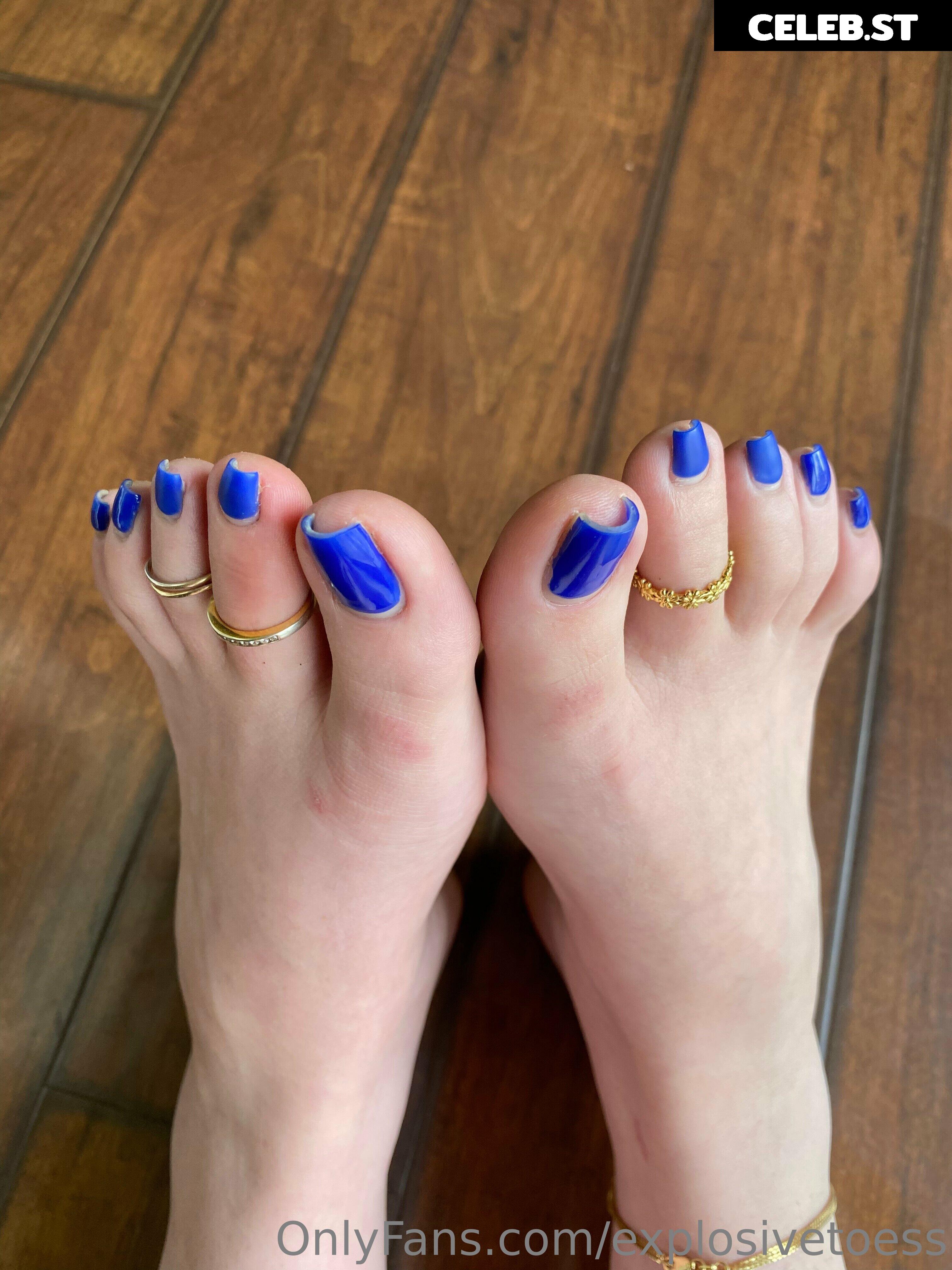 explosivetoess Image 17707570