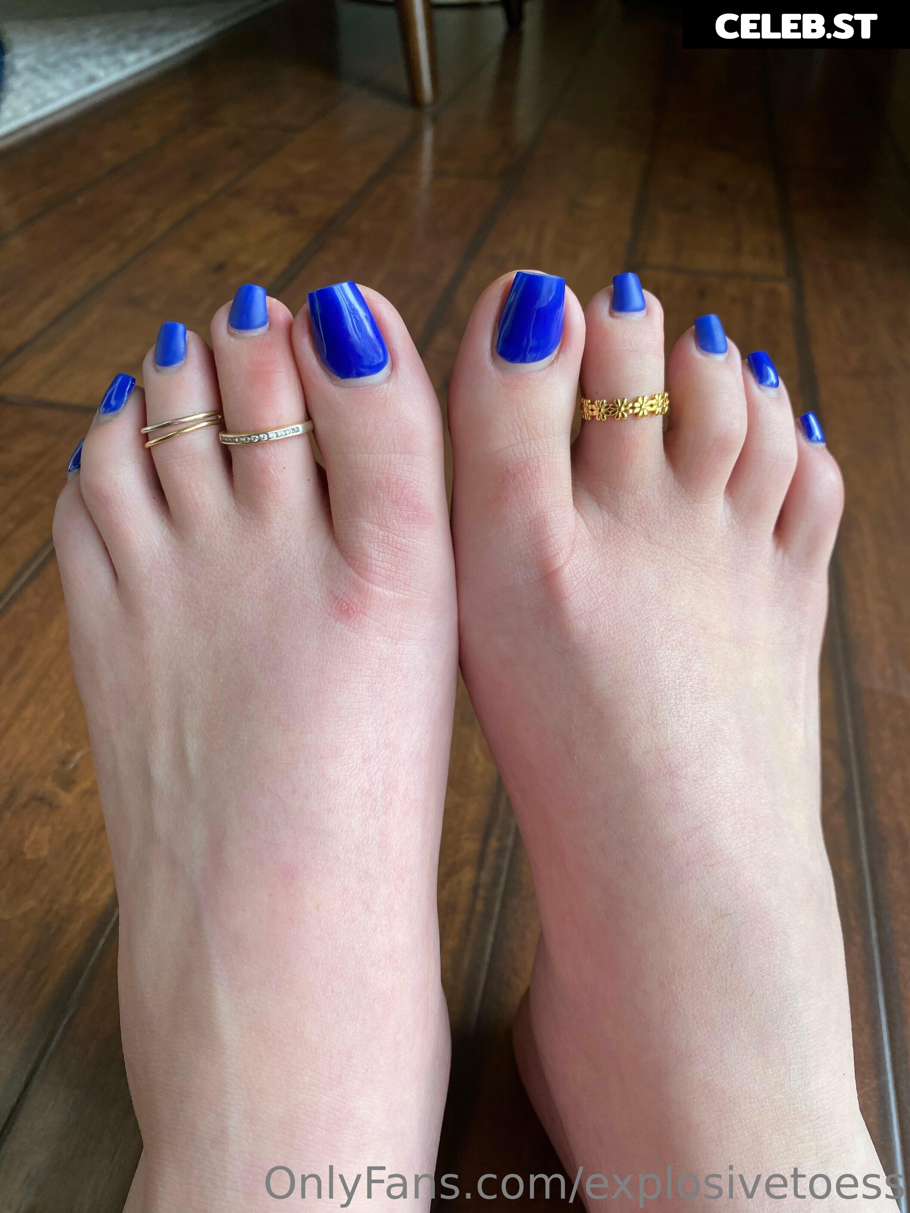 explosivetoess Image 17707778