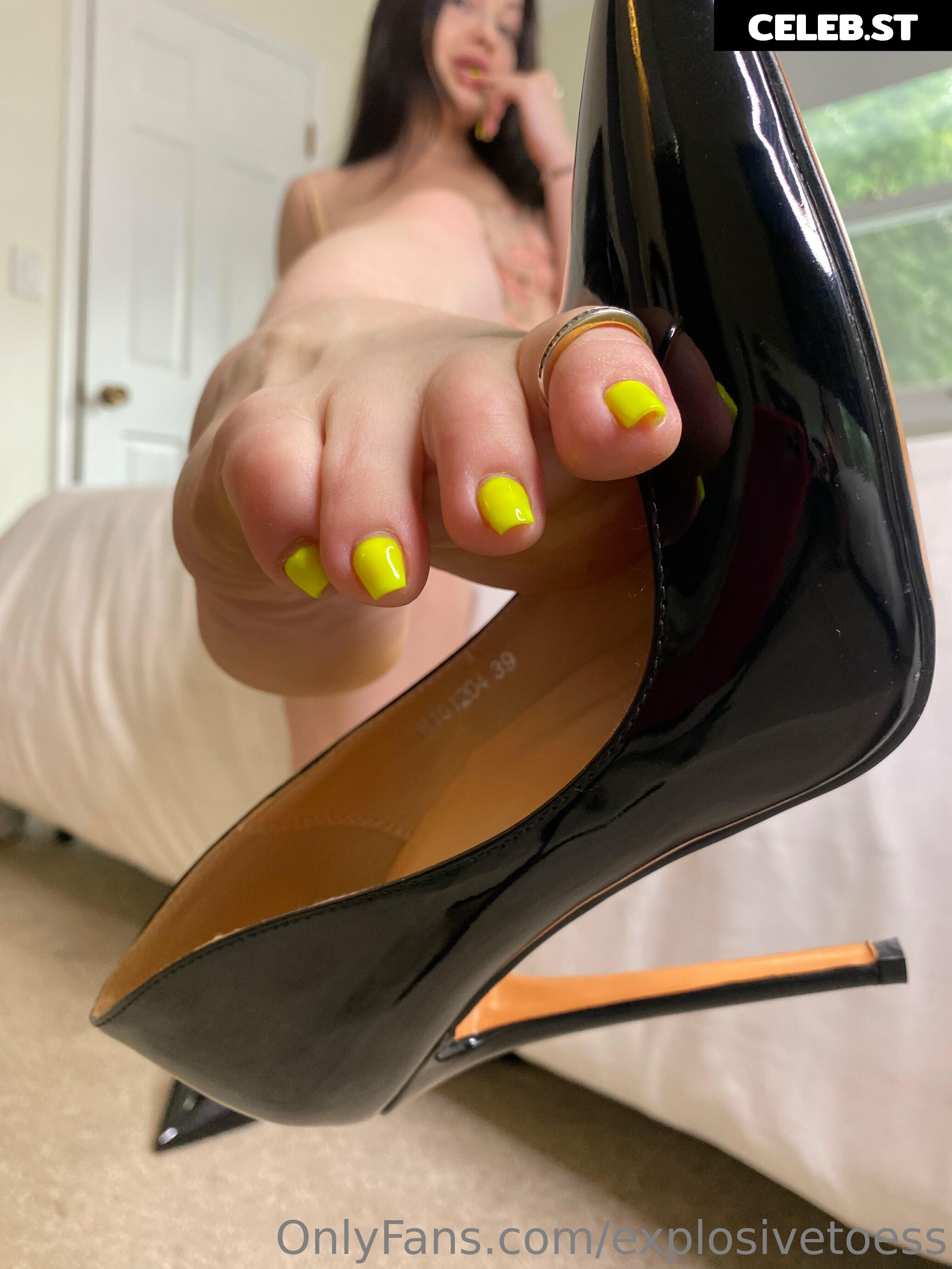 explosivetoess Image 17706576