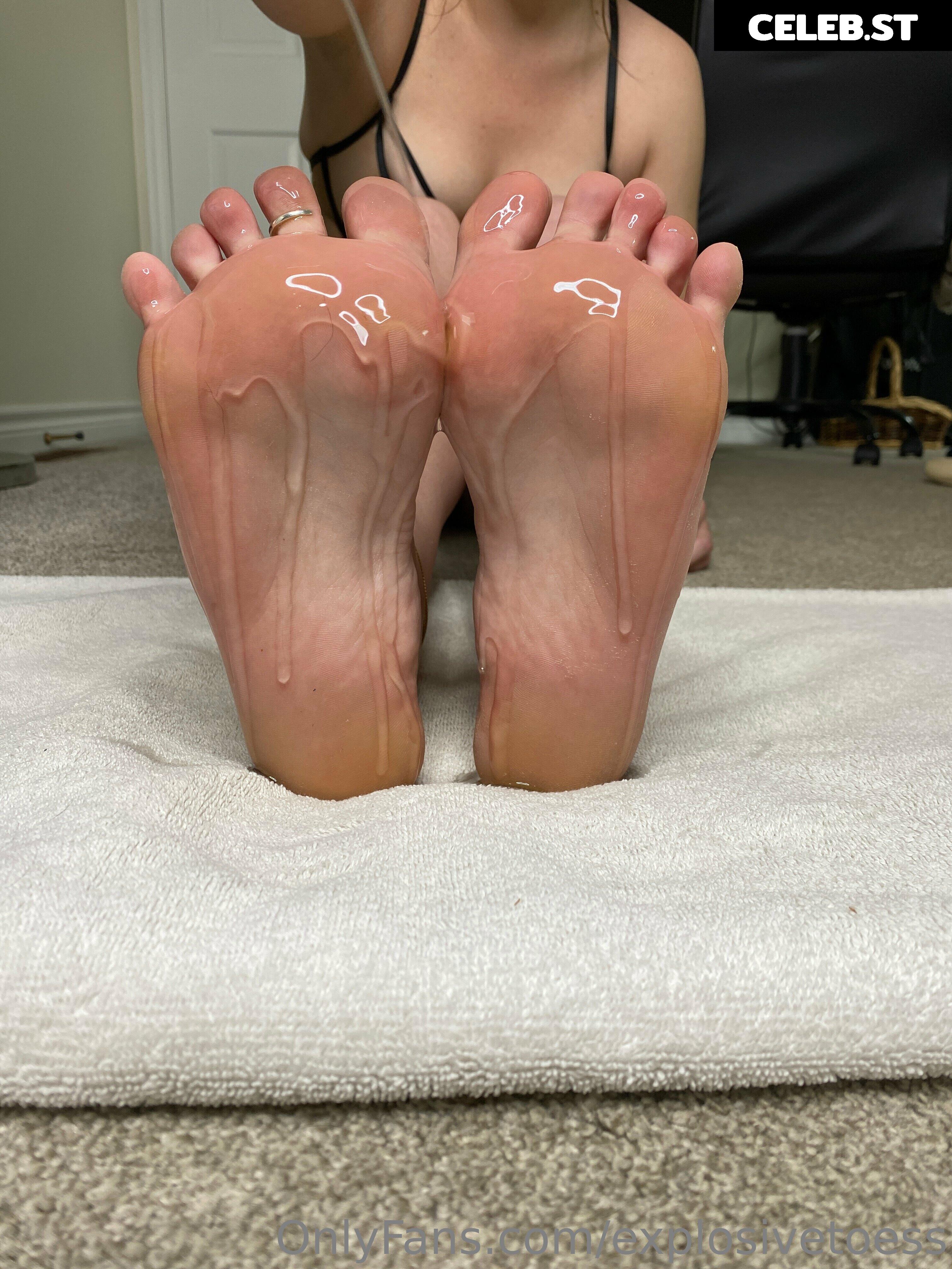 explosivetoess Image 17706482