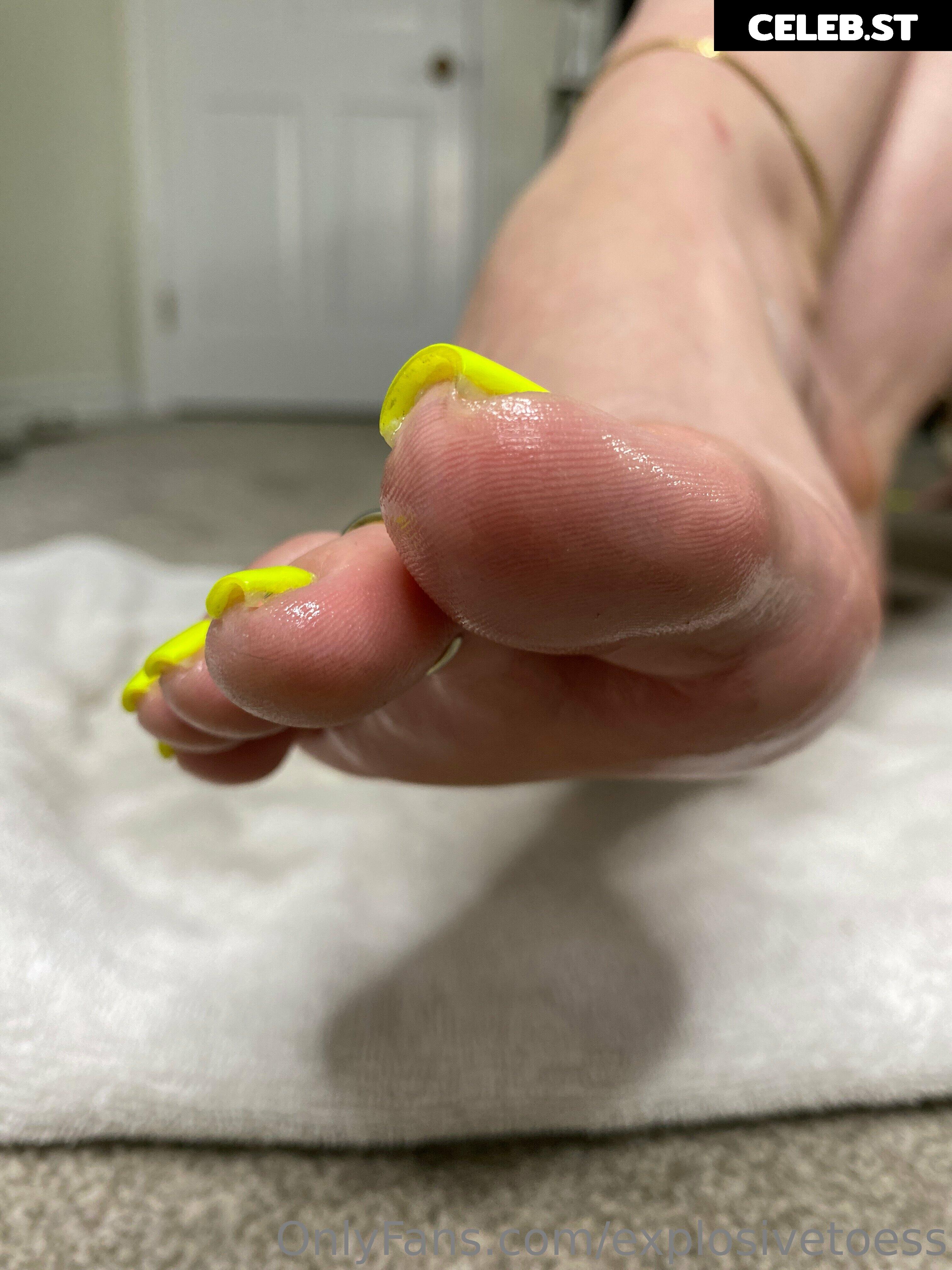 explosivetoess Image 17706633