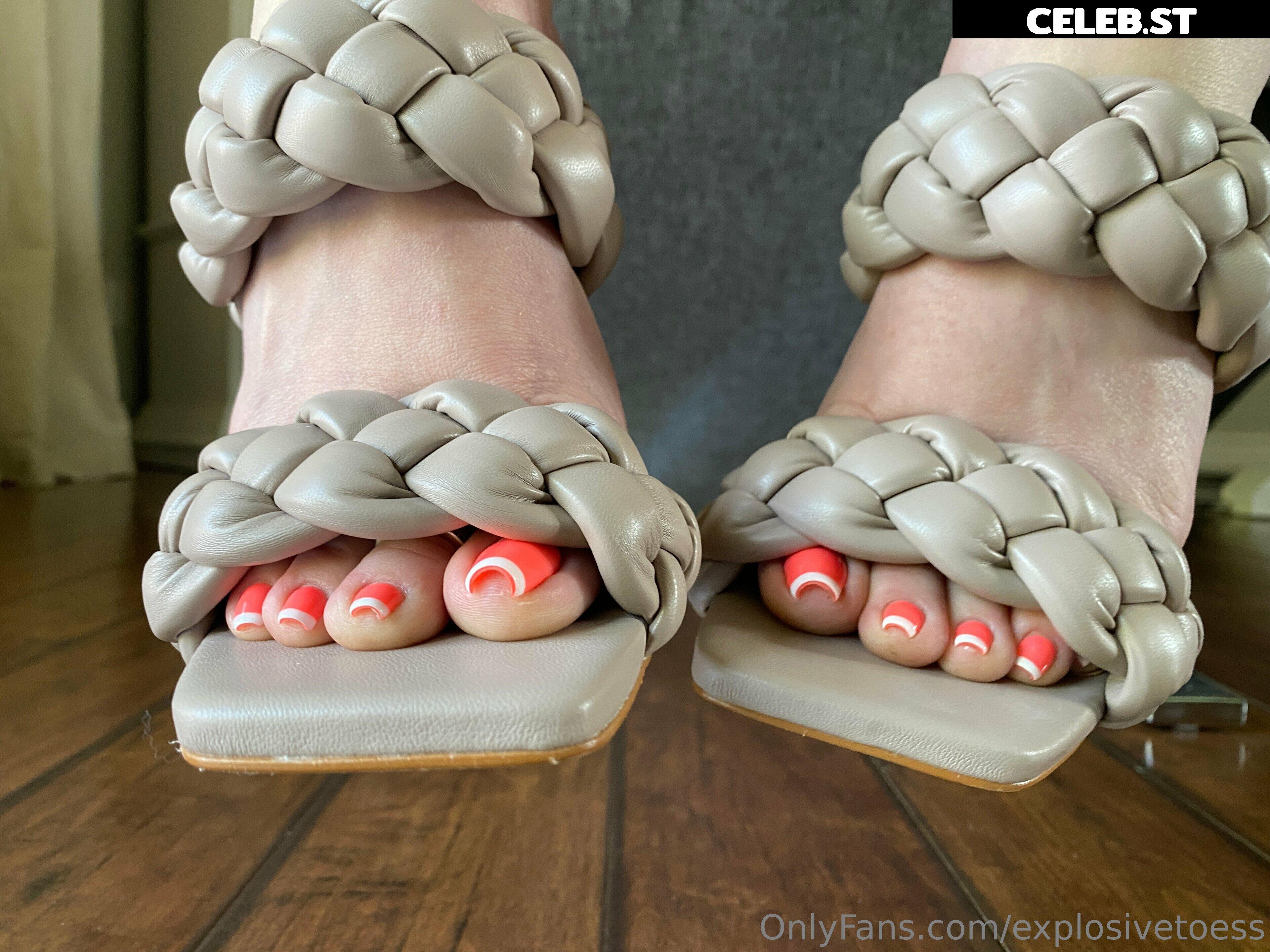 explosivetoess Image 17706182