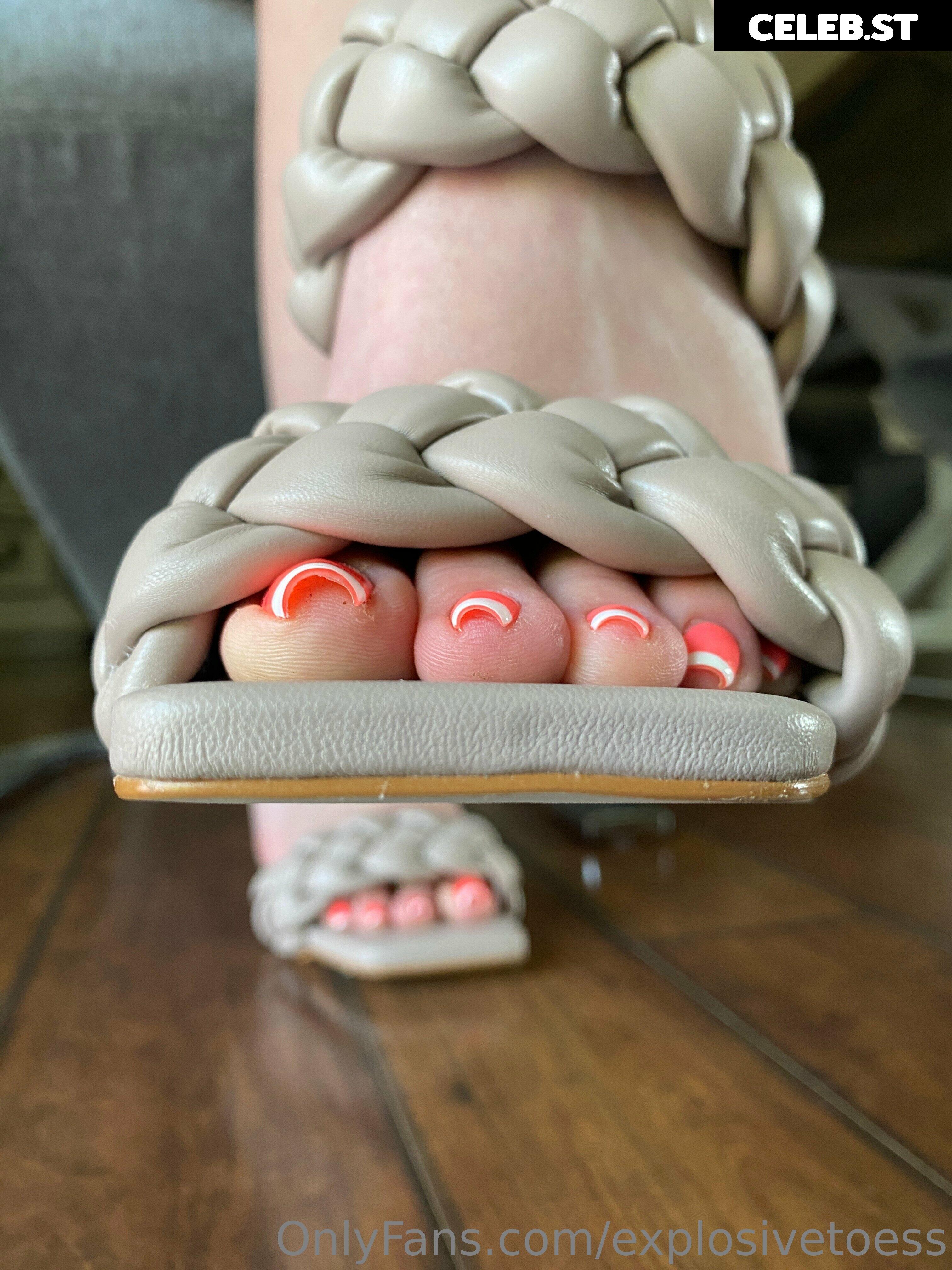 explosivetoess Image 17706043