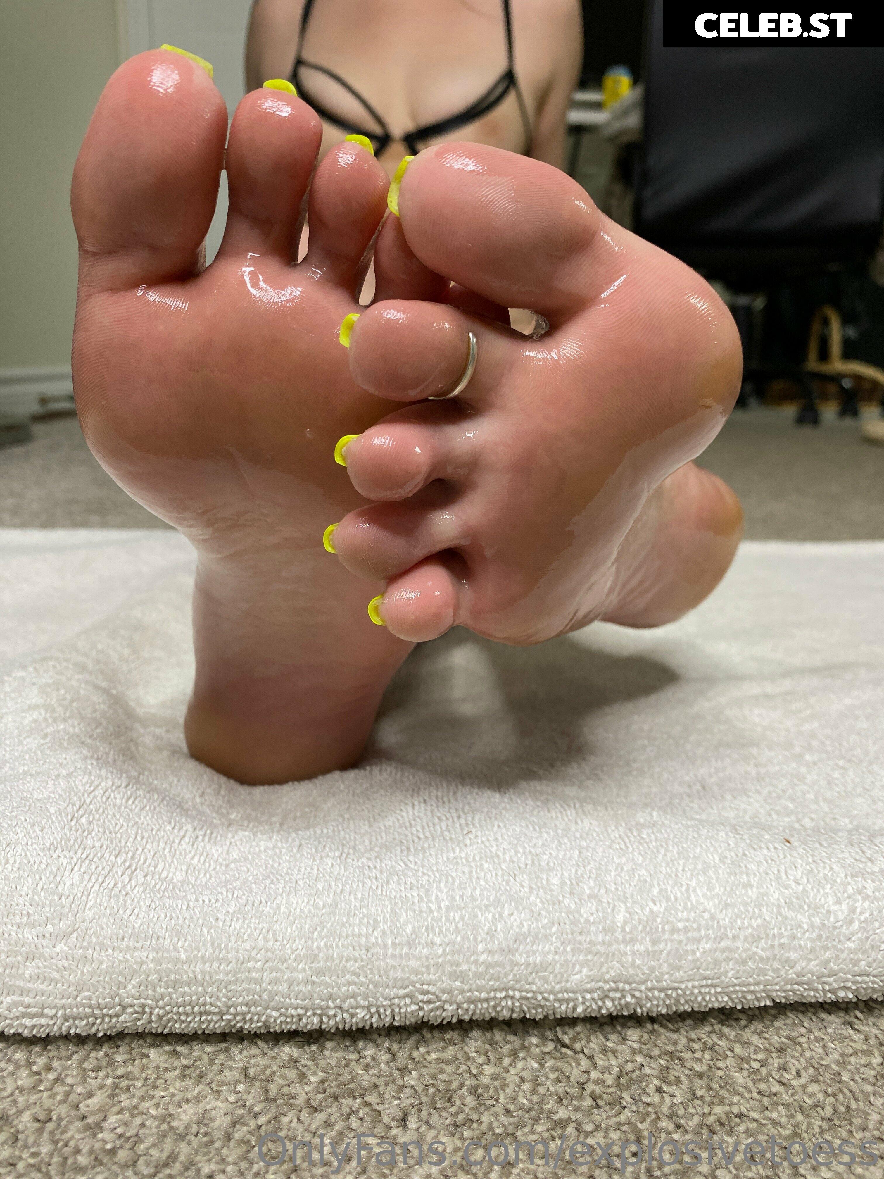 explosivetoess Image 17706386