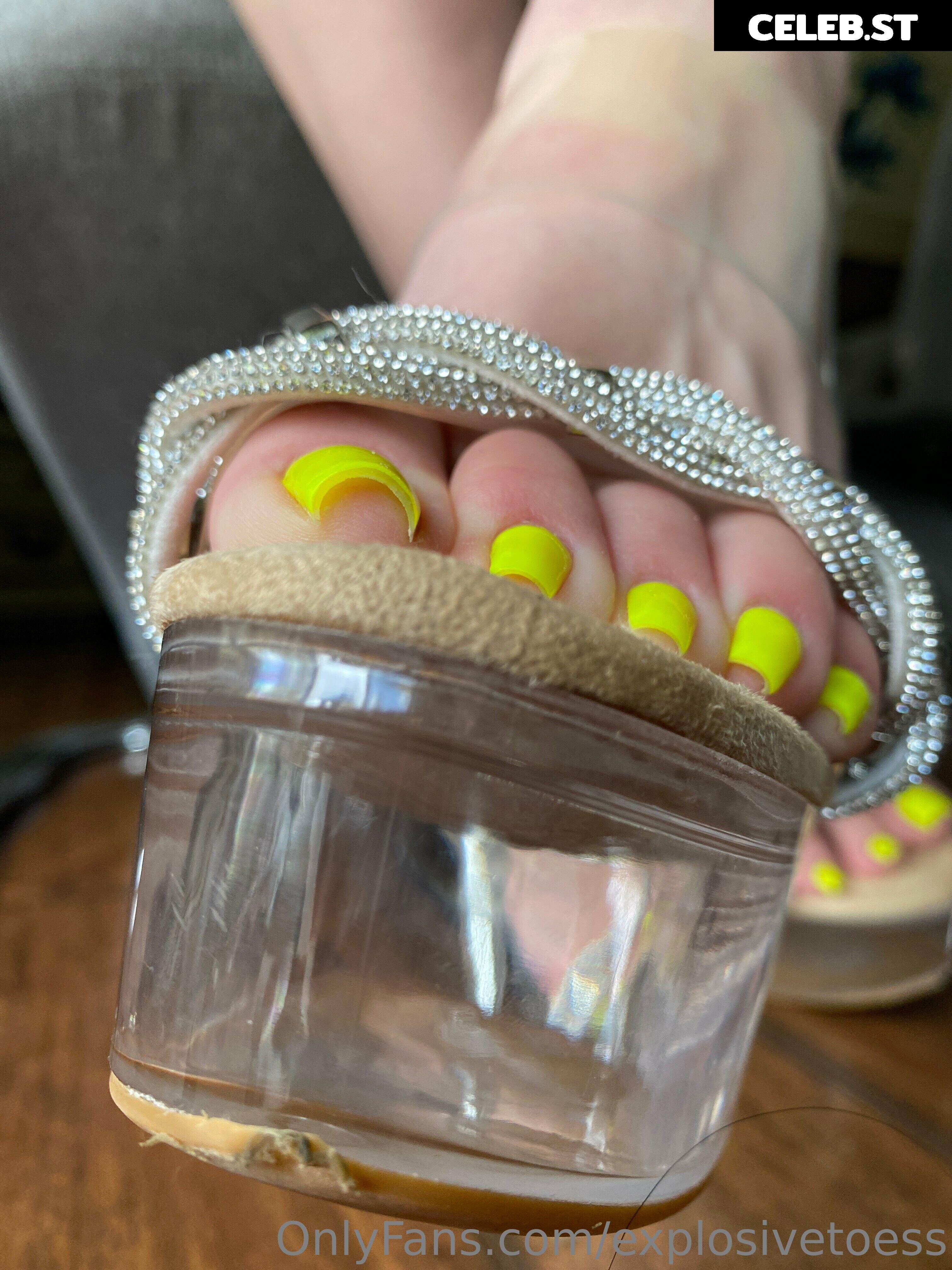 explosivetoess Image 17706253