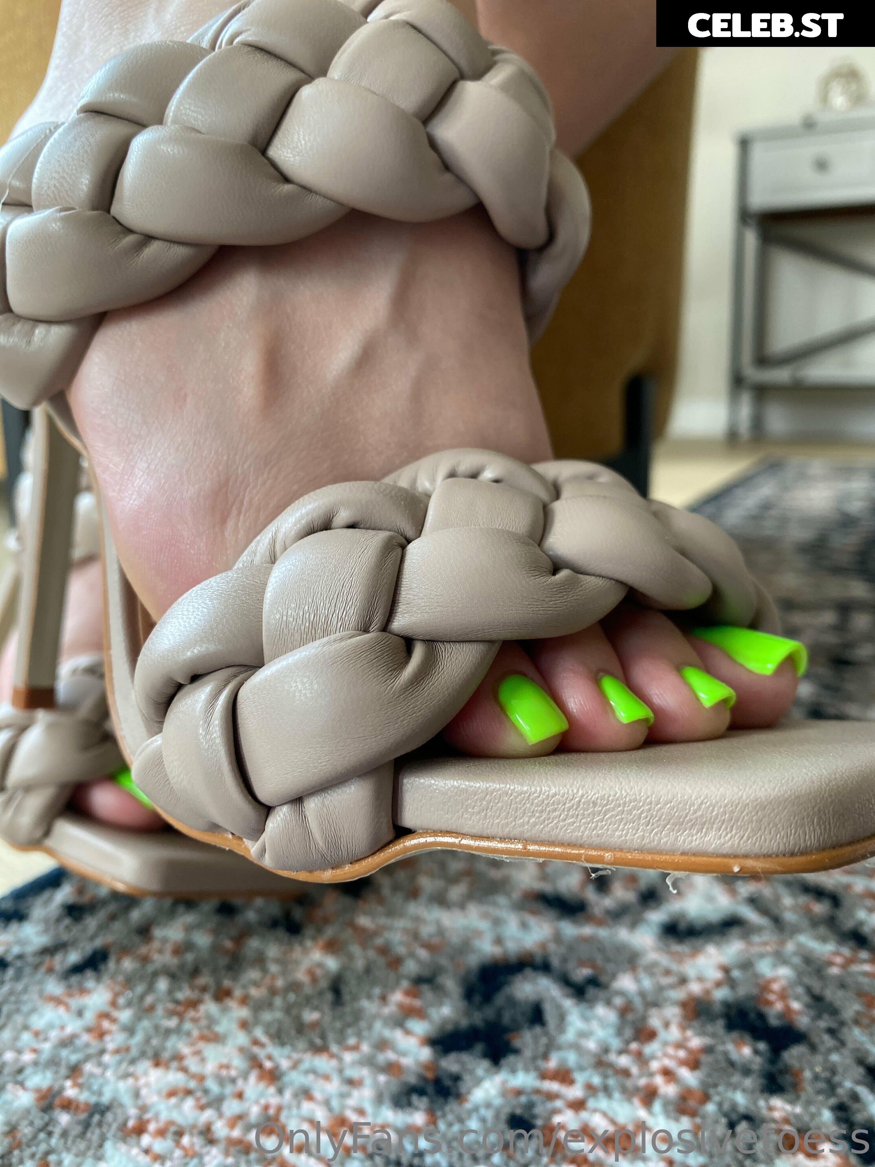 explosivetoess Image 17700594
