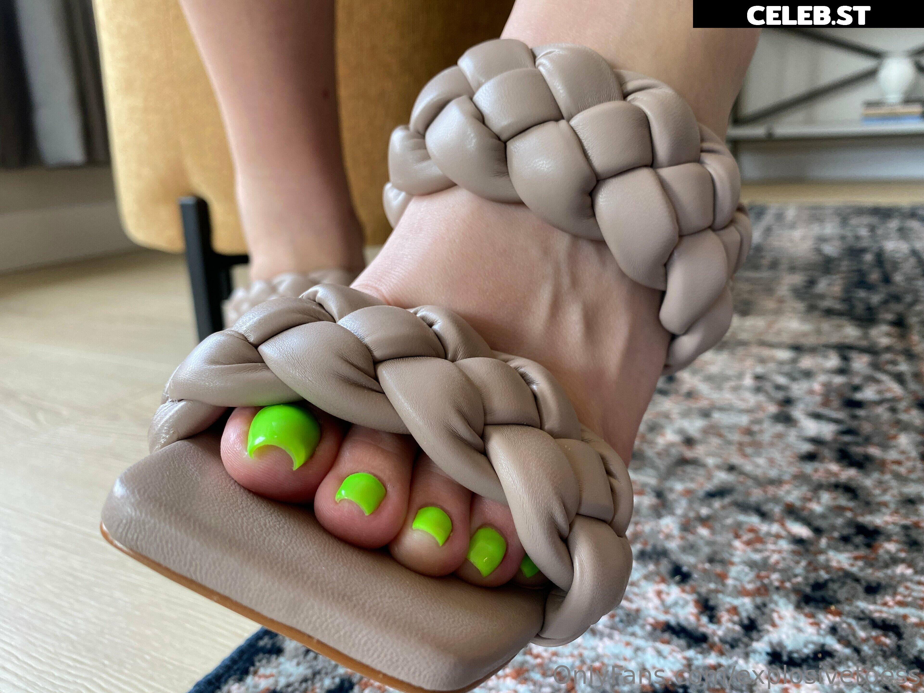 explosivetoess Image 17700553
