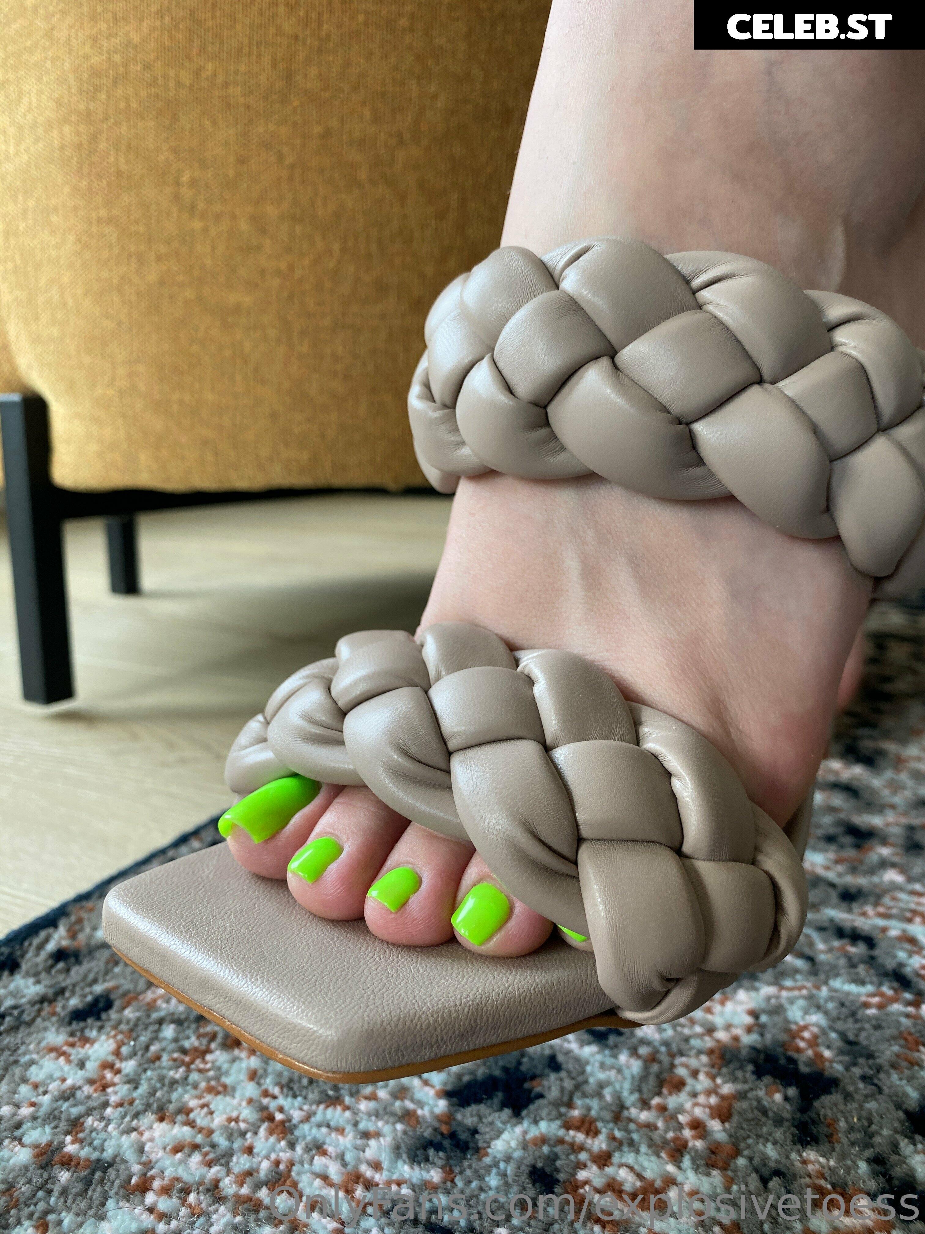 explosivetoess Image 17700541