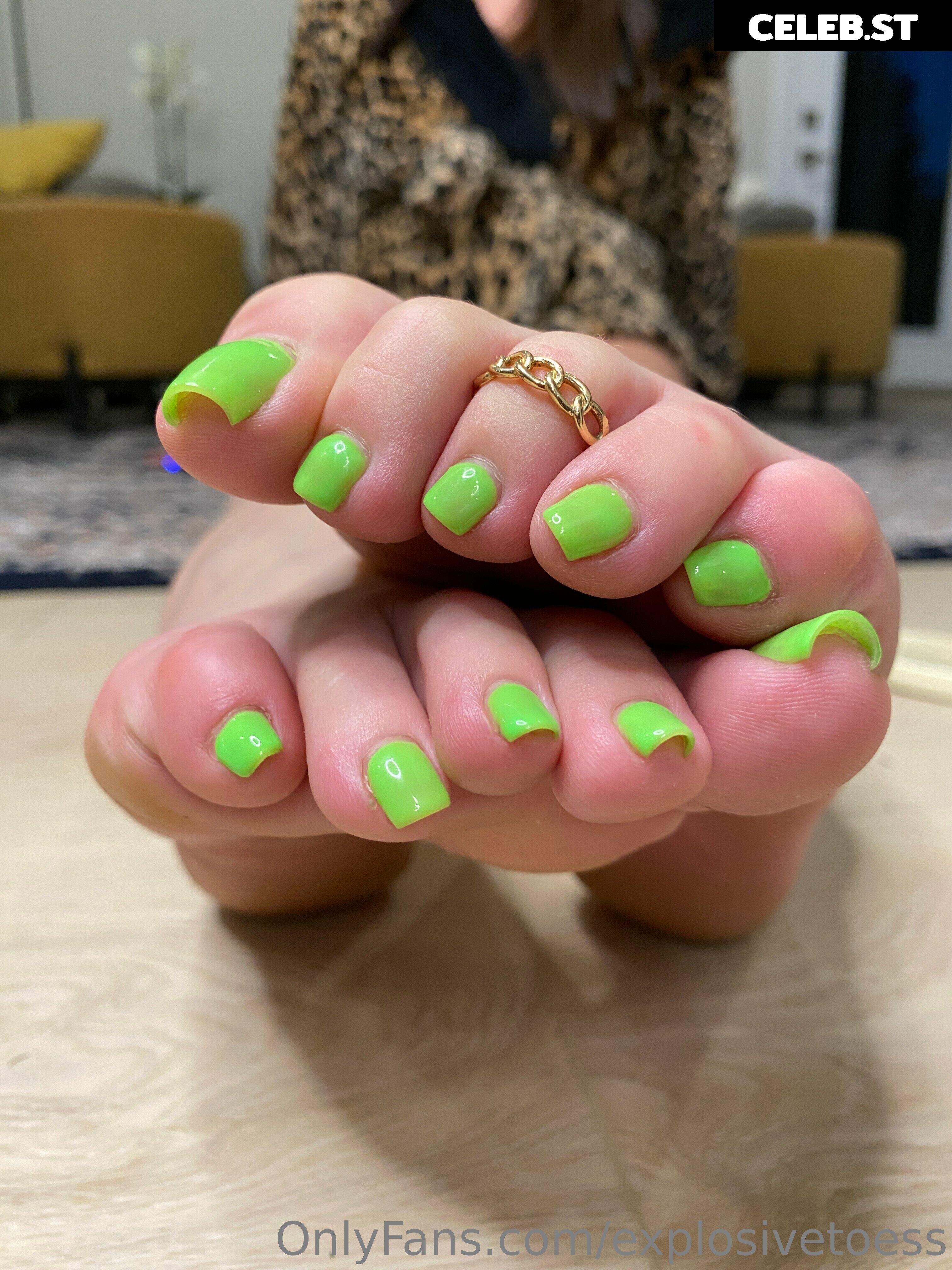 explosivetoess Image 17700468