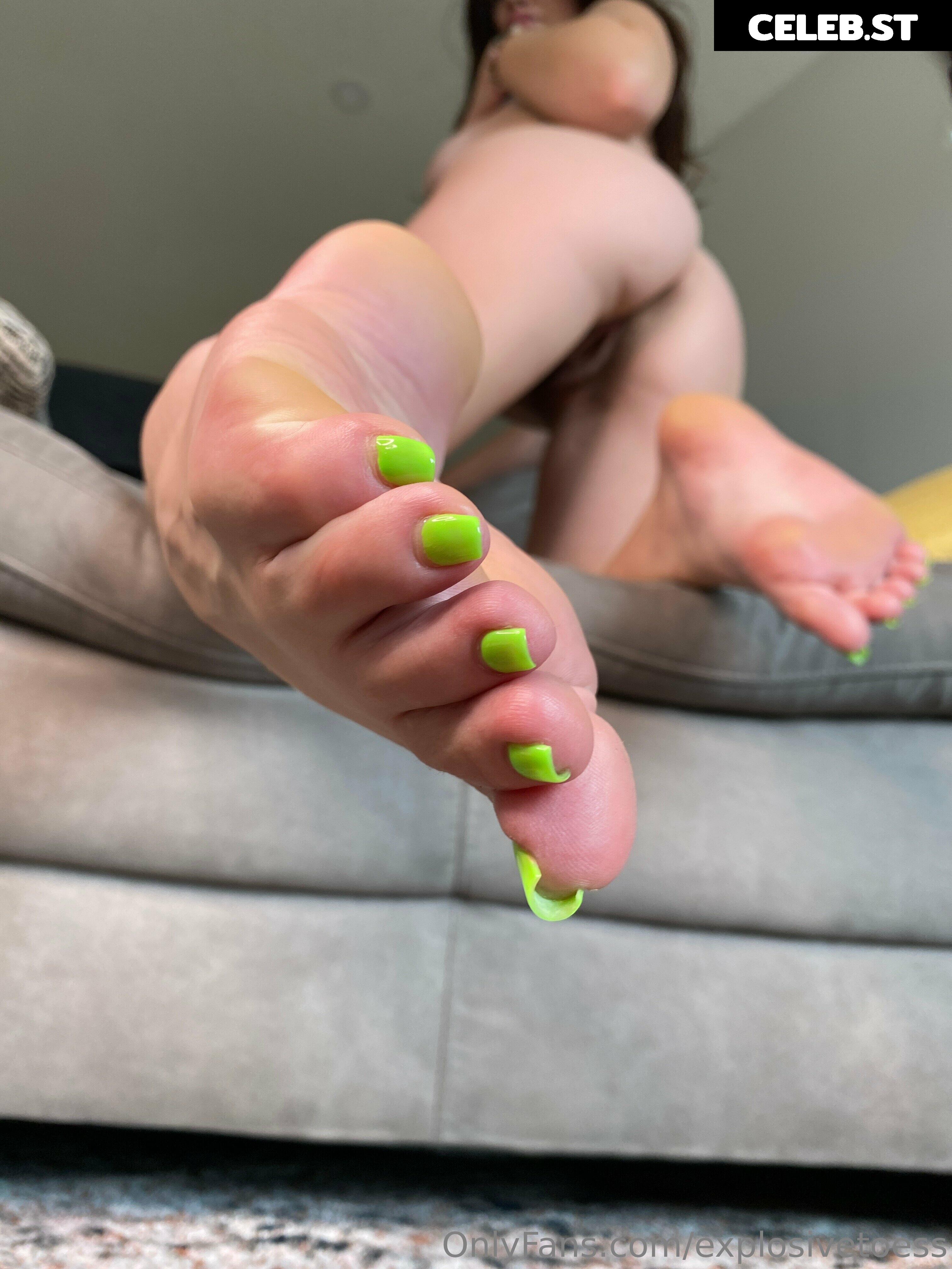 explosivetoess Image 17700254