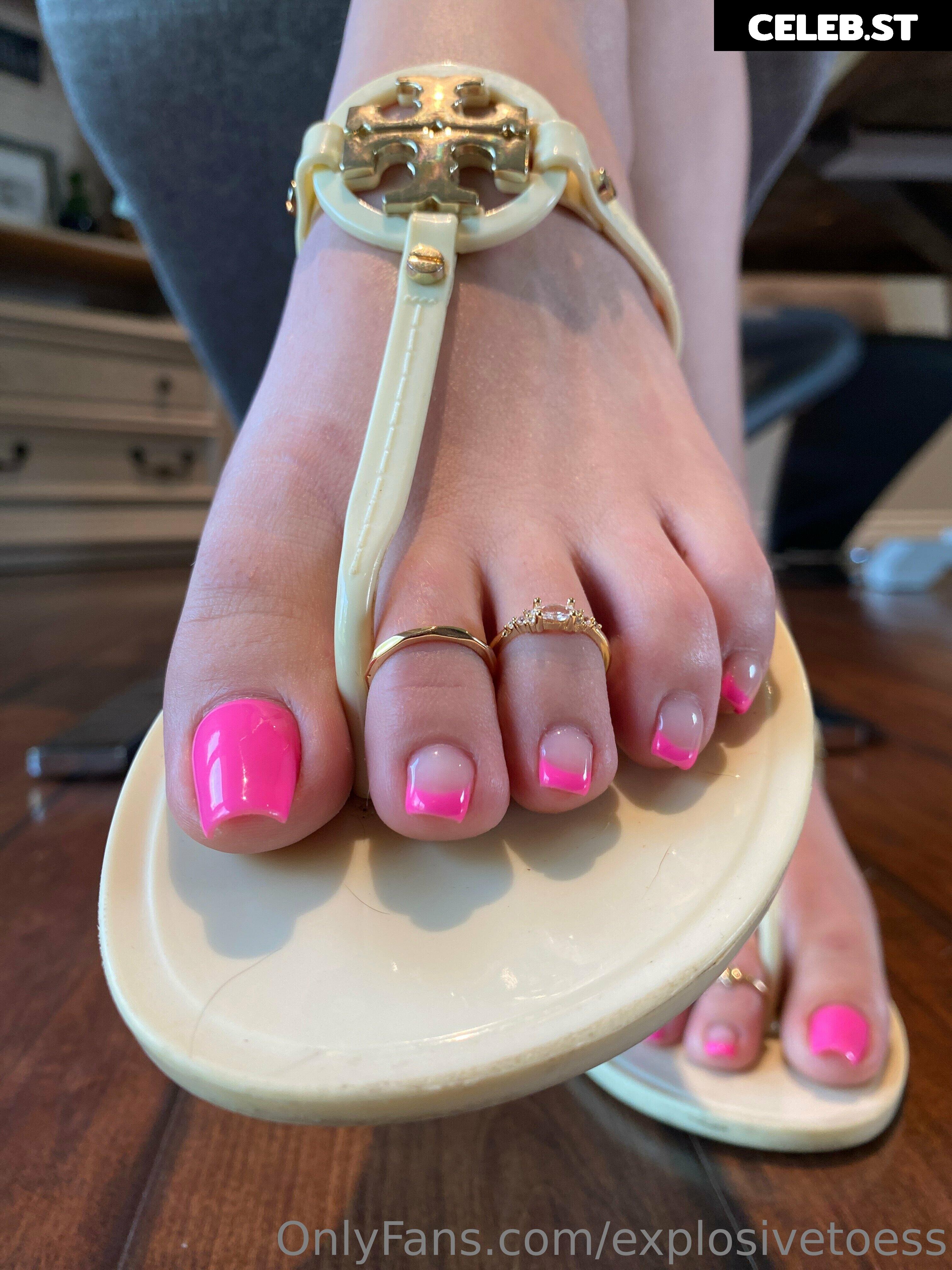 explosivetoess Image 17702291