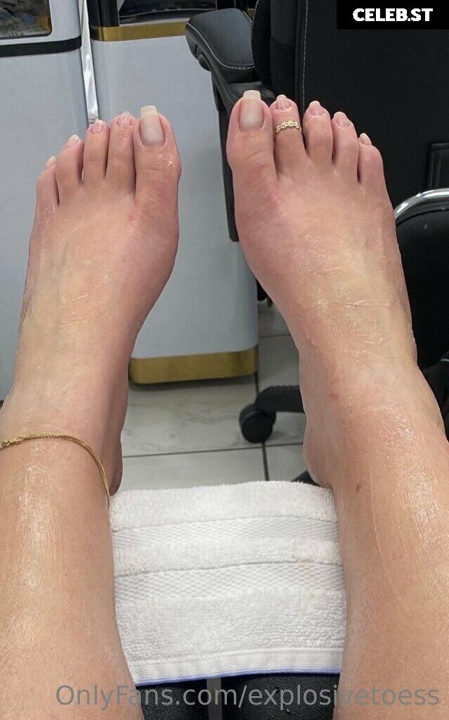 explosivetoess Image 17702284