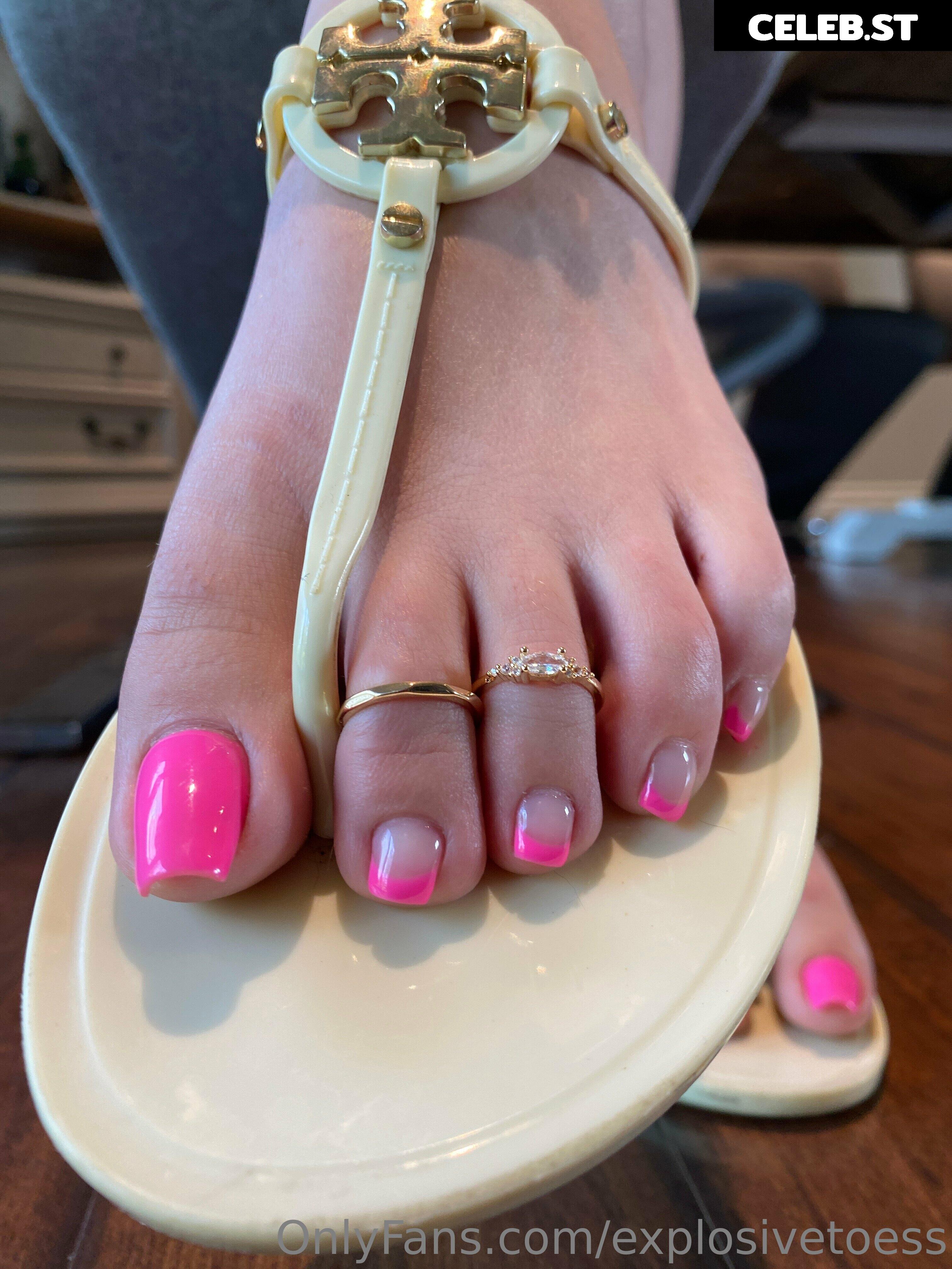 explosivetoess Image 17702267