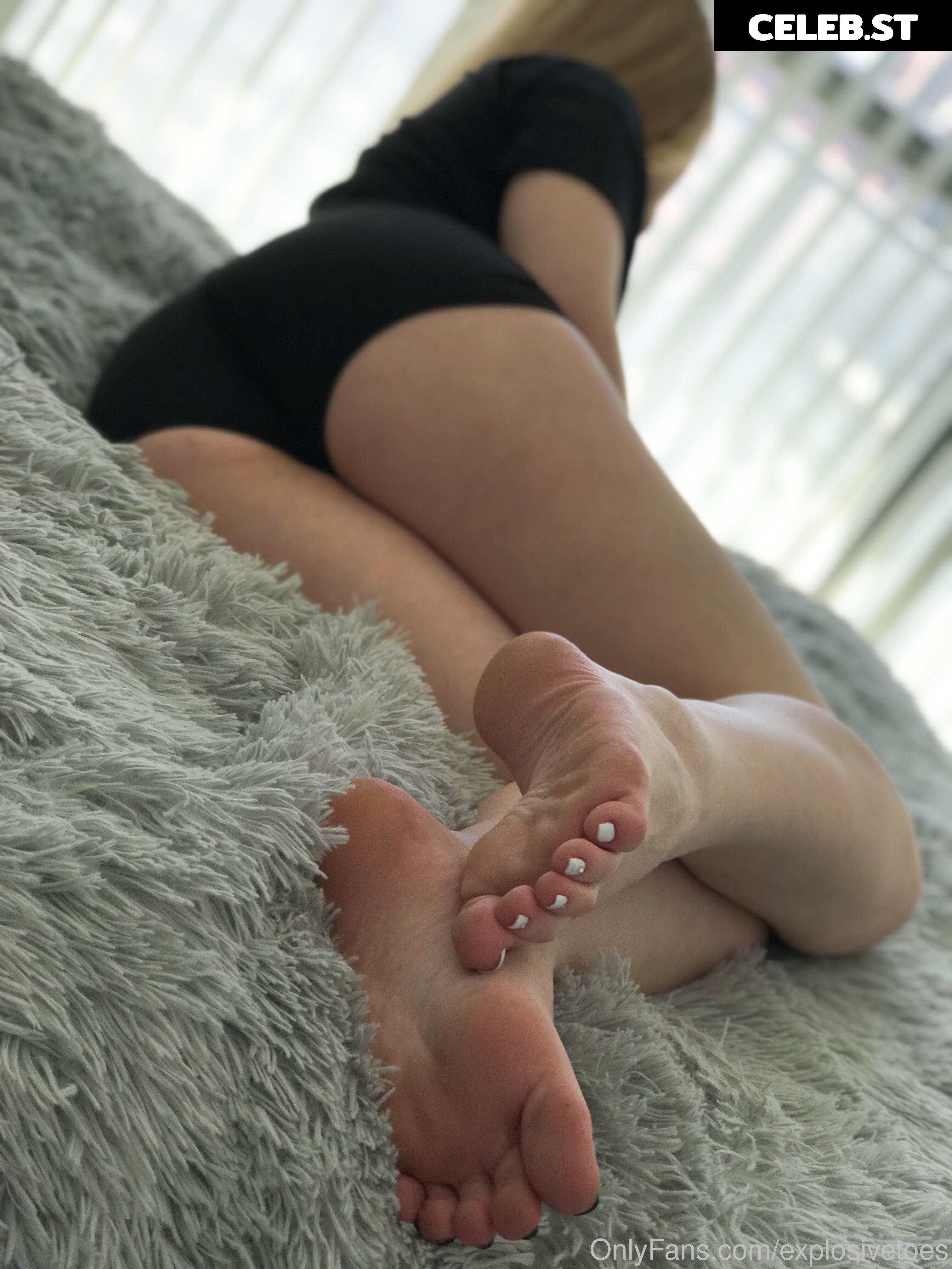 explosivetoess Image 17784037