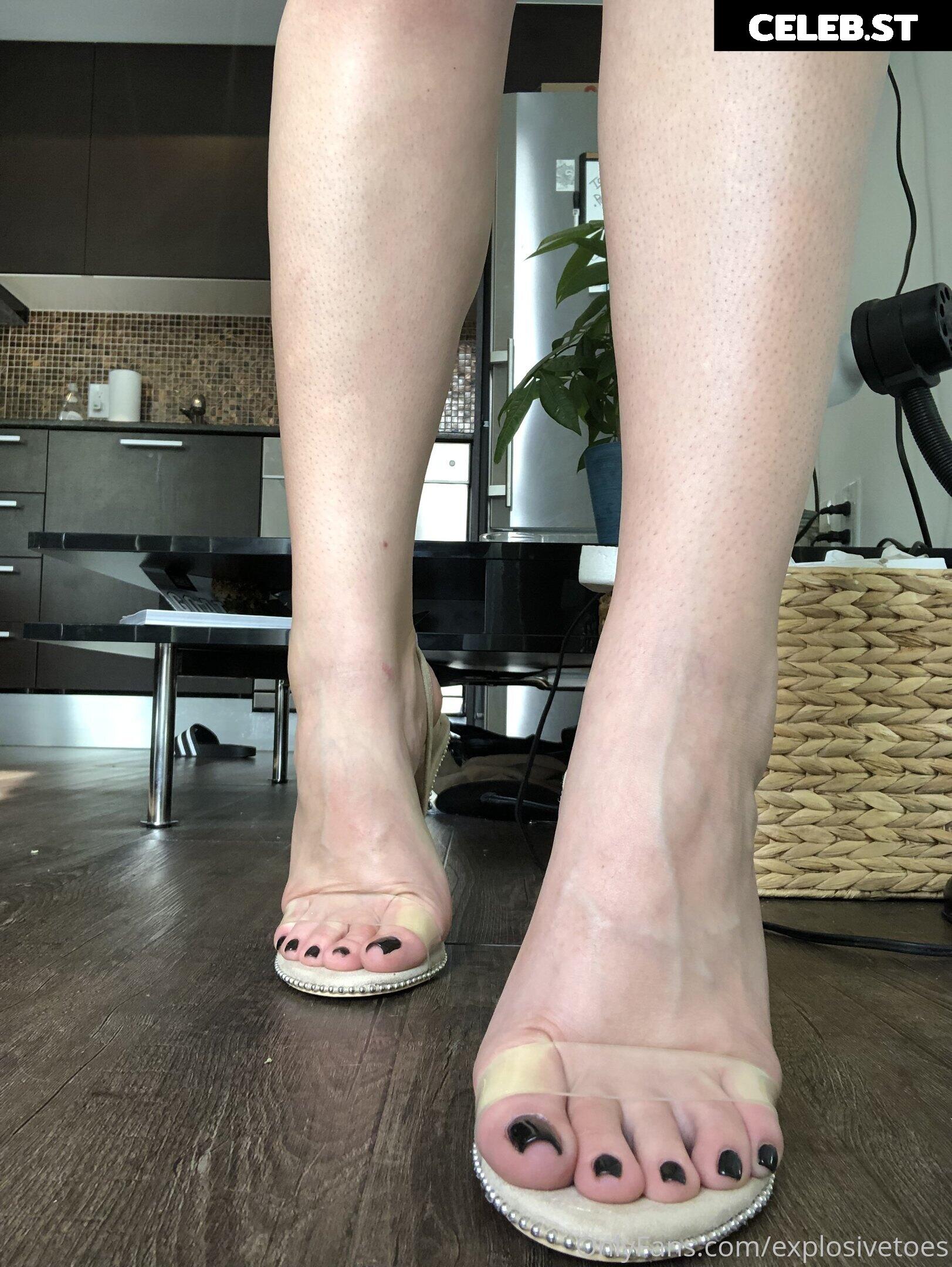 explosivetoess Image 17781773