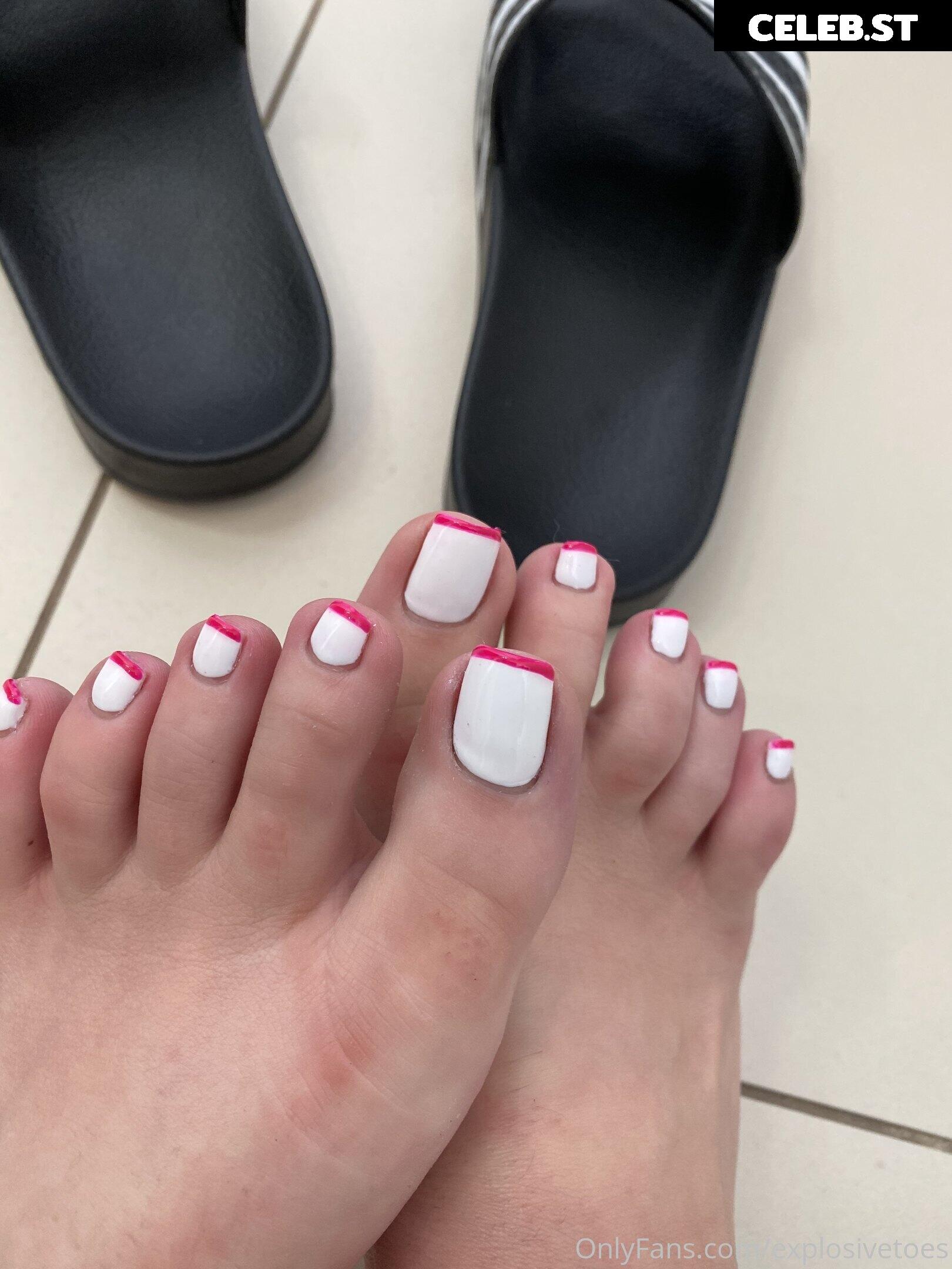 explosivetoess Image 17780960