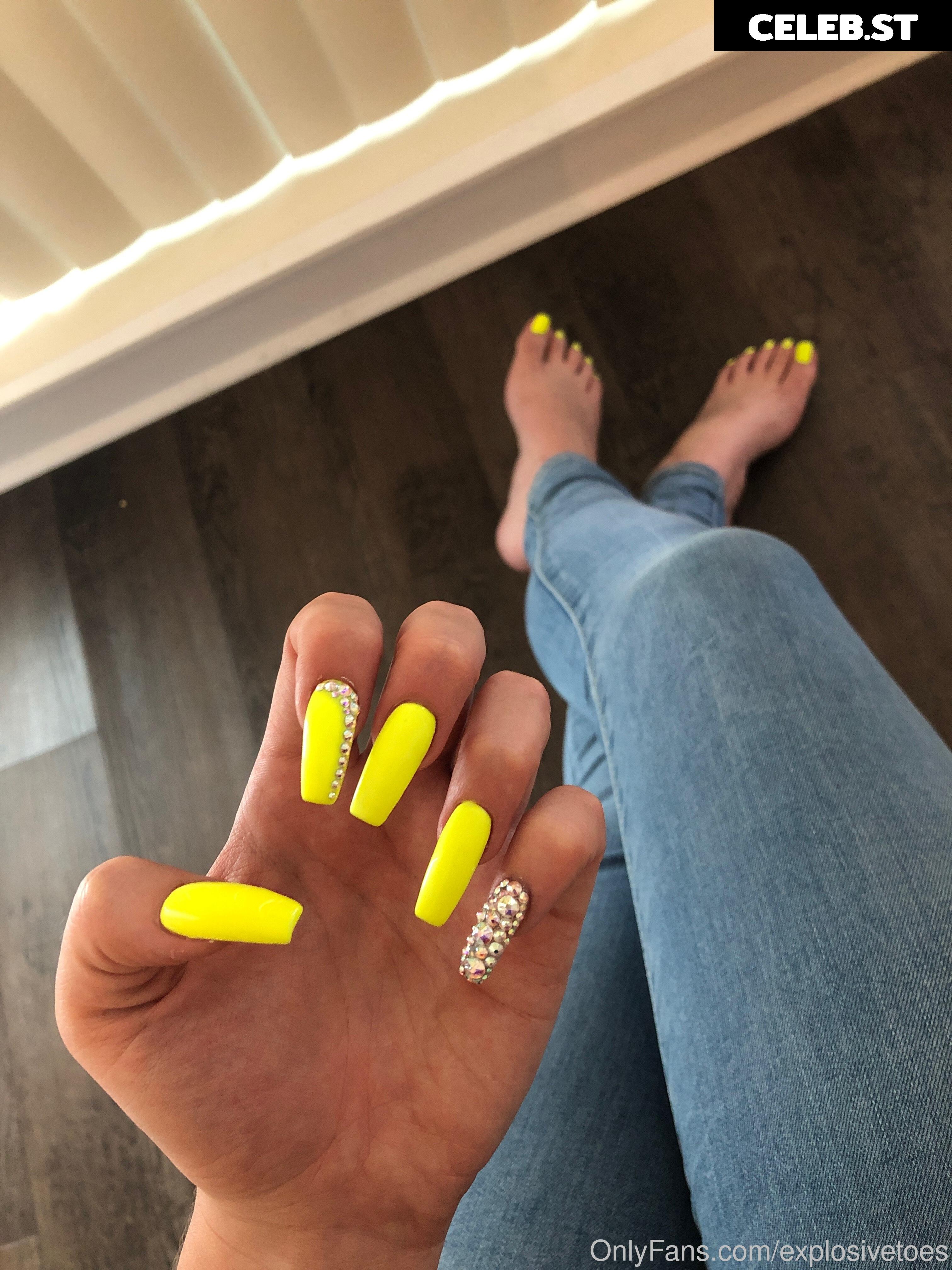 explosivetoess Image 17783197