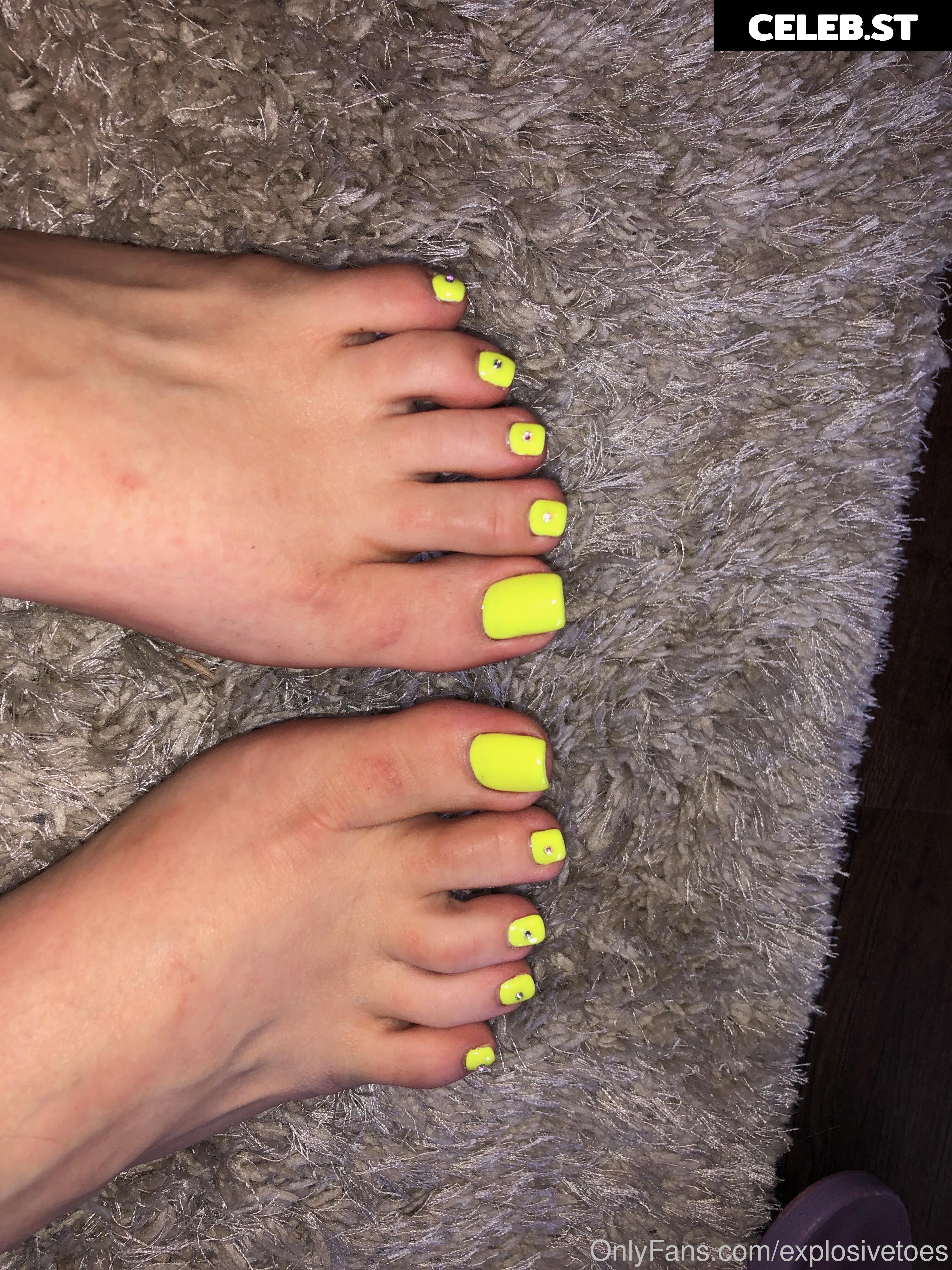 explosivetoess Image 17783195