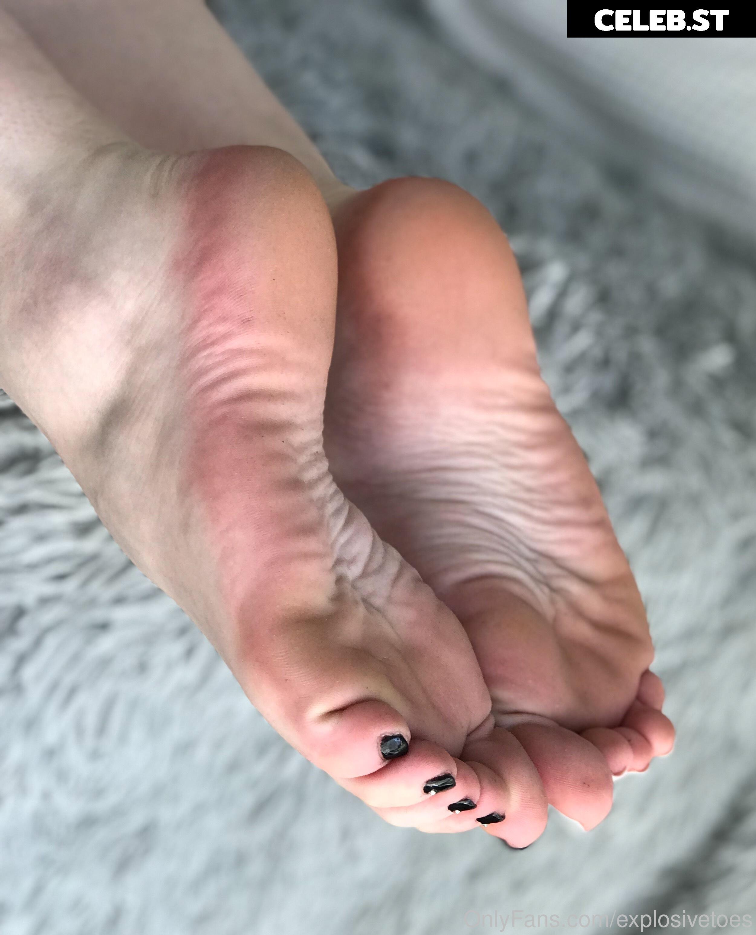 explosivetoess Image 17783124
