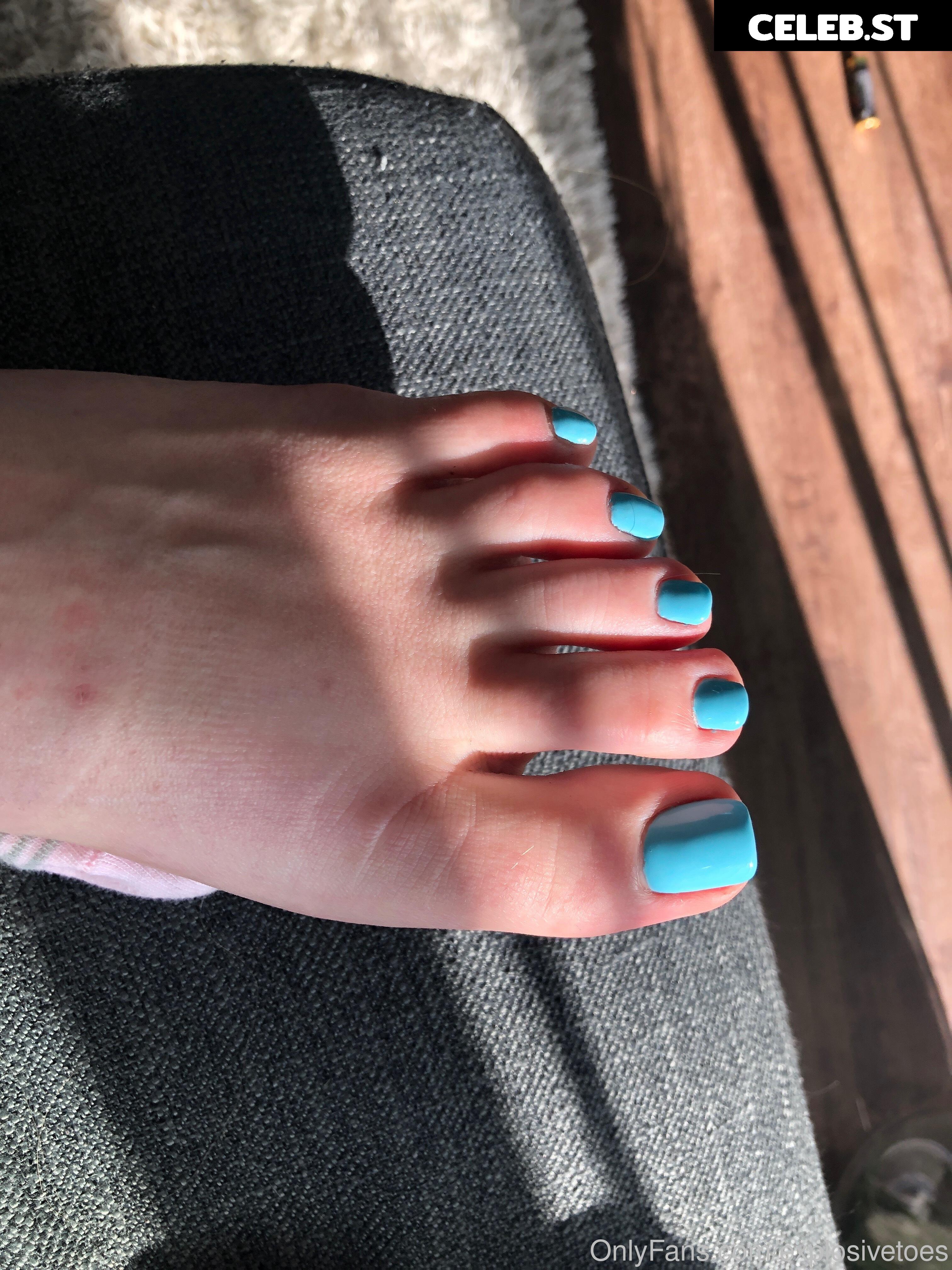 explosivetoess Image 17783109
