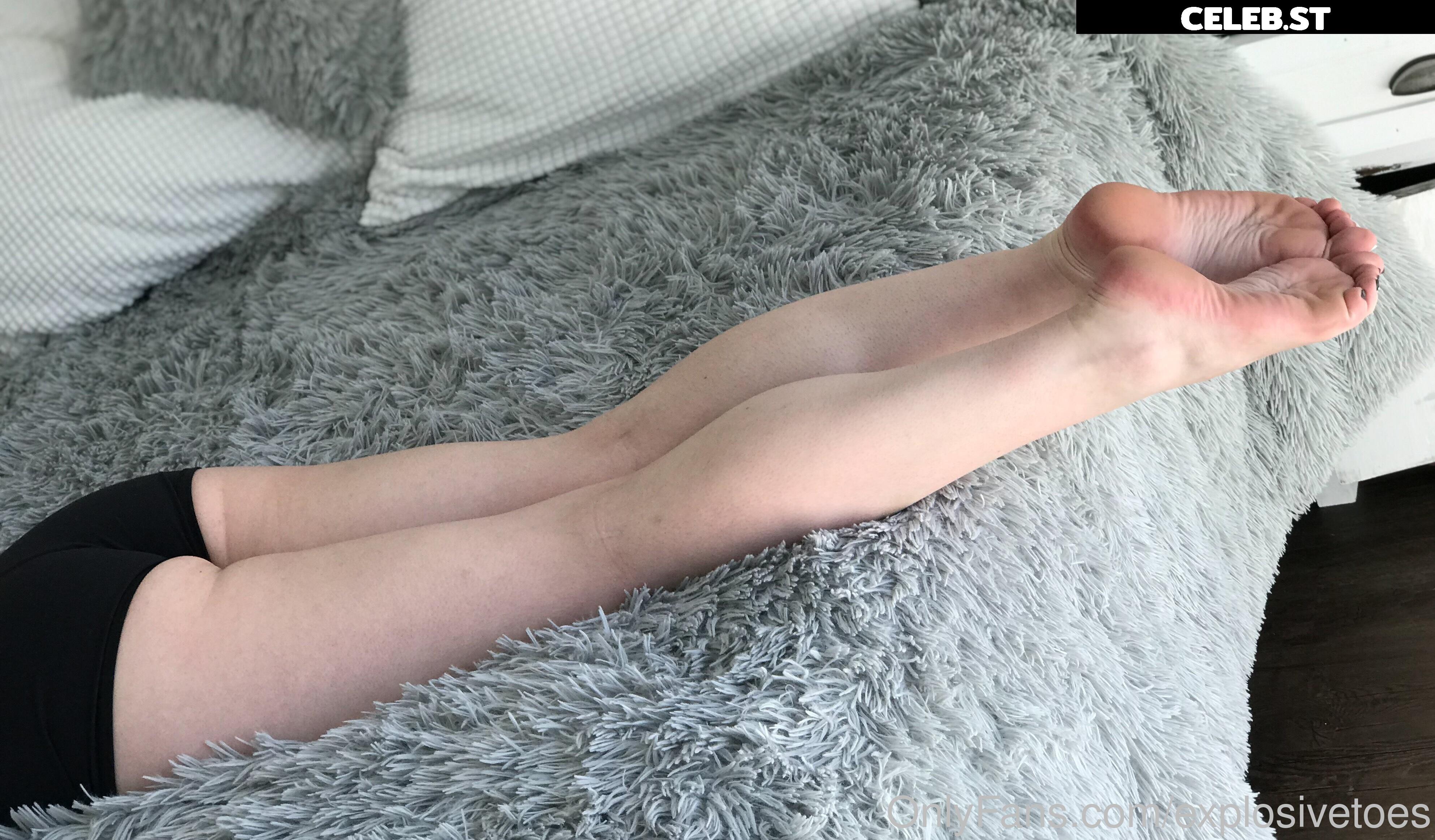 explosivetoess Image 17783139