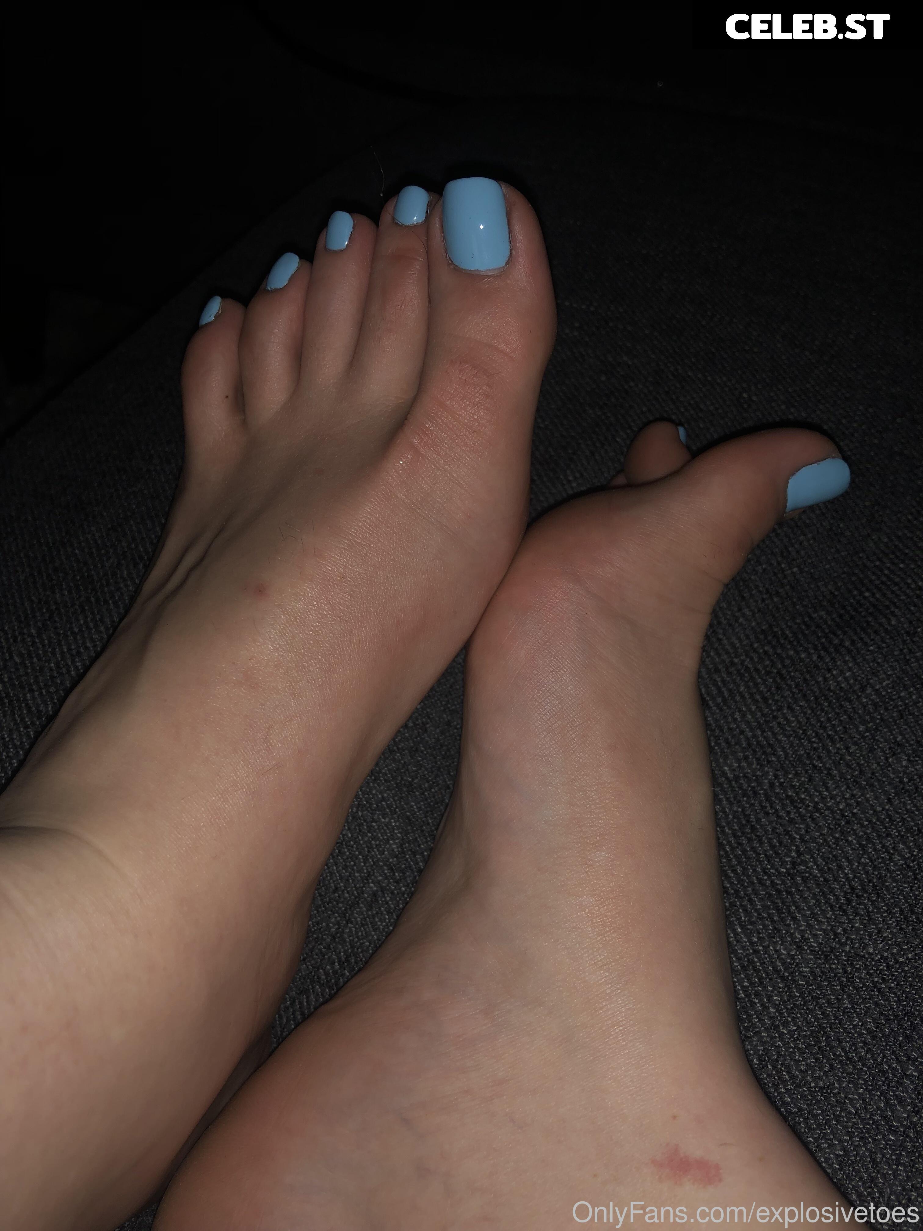 explosivetoess Image 17783204