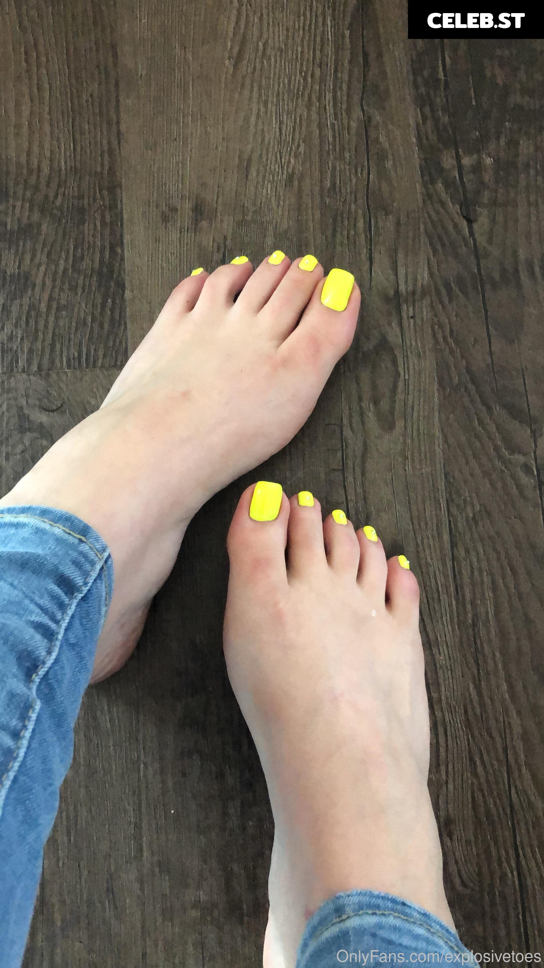 explosivetoess Image 17783248