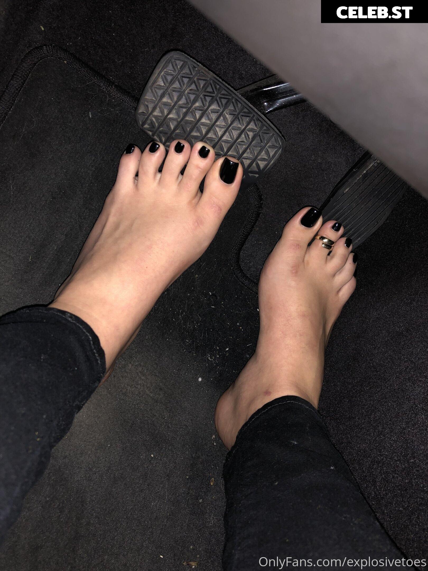 explosivetoess Image 17782127