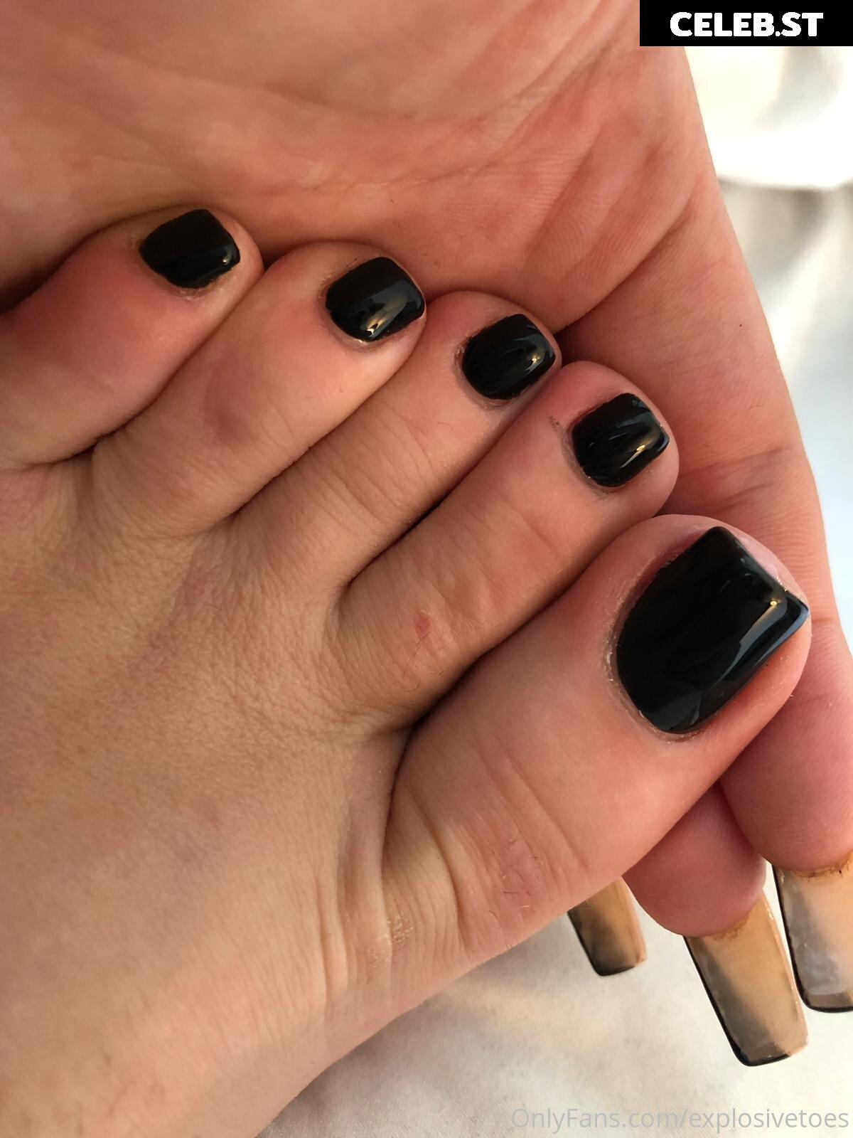 explosivetoess Image 17782103