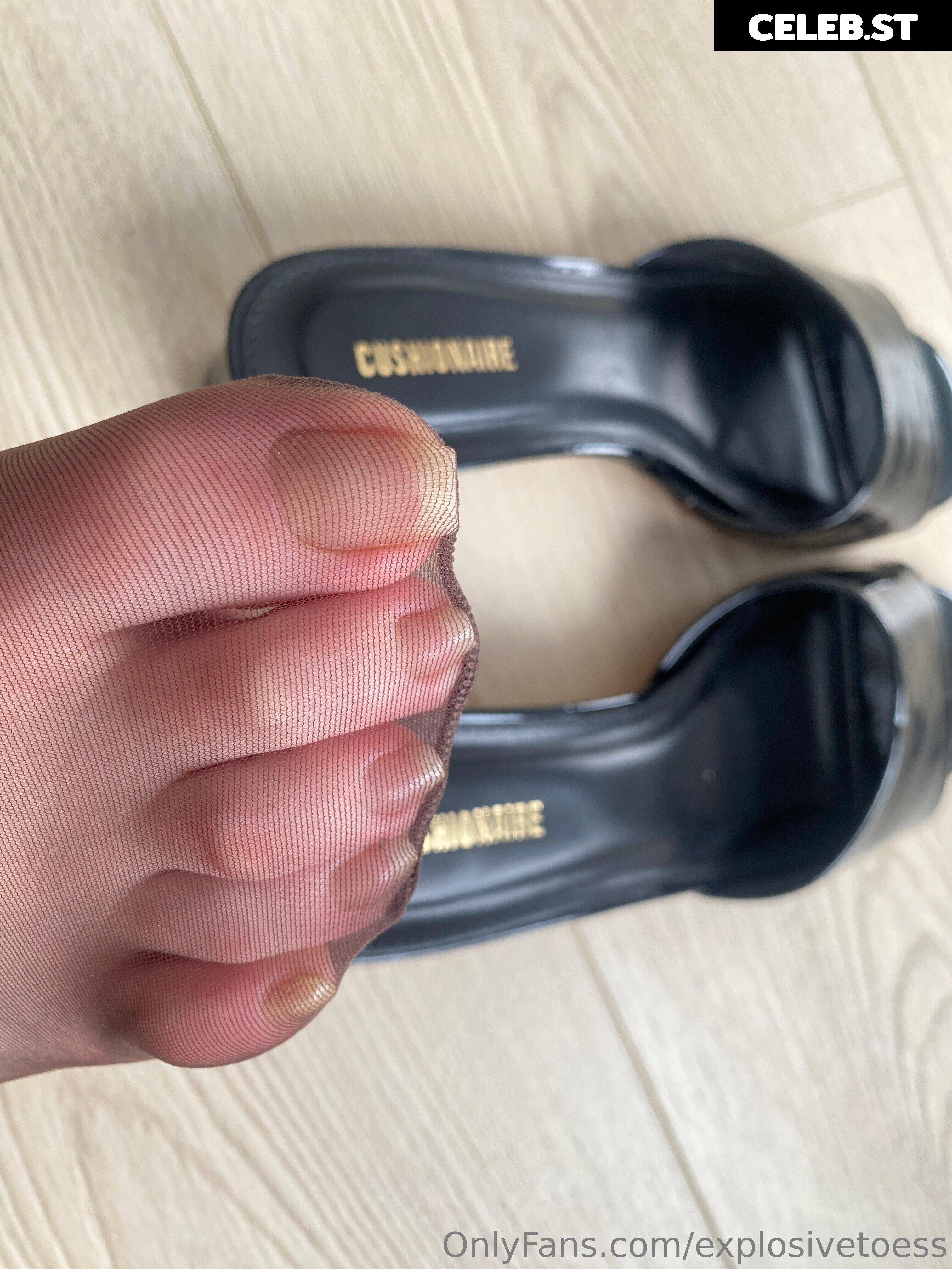explosivetoess Image 17699812