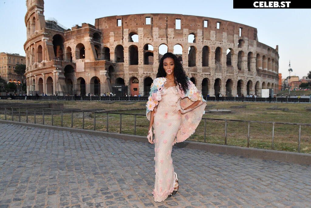 Winnie Harlow Image 1744523