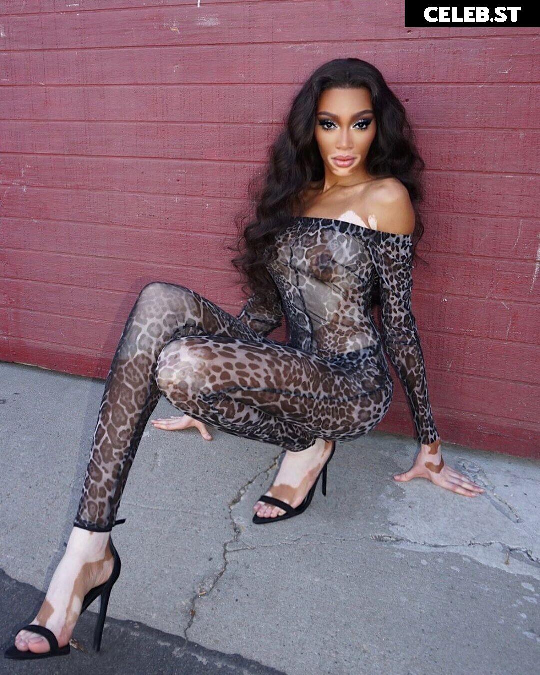 Winnie Harlow Image 1744770