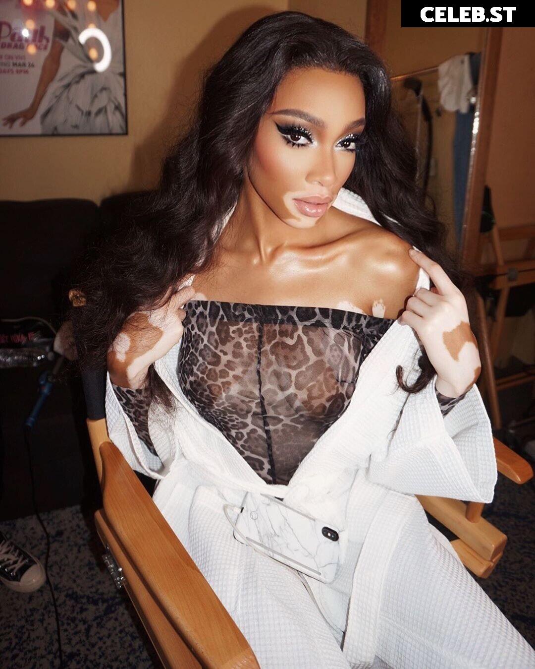 Winnie Harlow Image 1744701