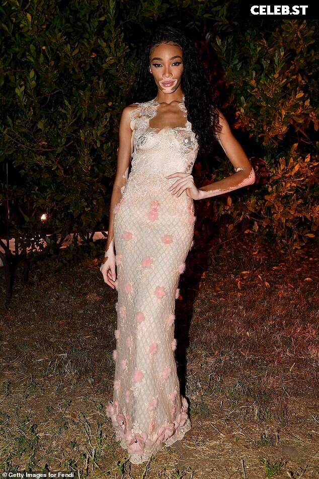 Winnie Harlow Image 1744682