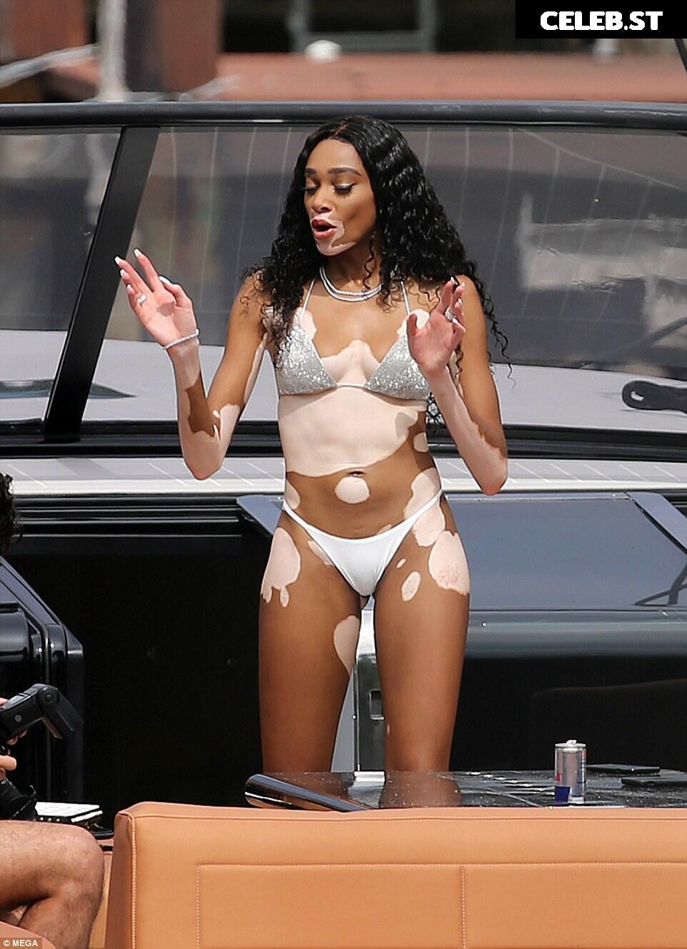 Winnie Harlow Image 1741419