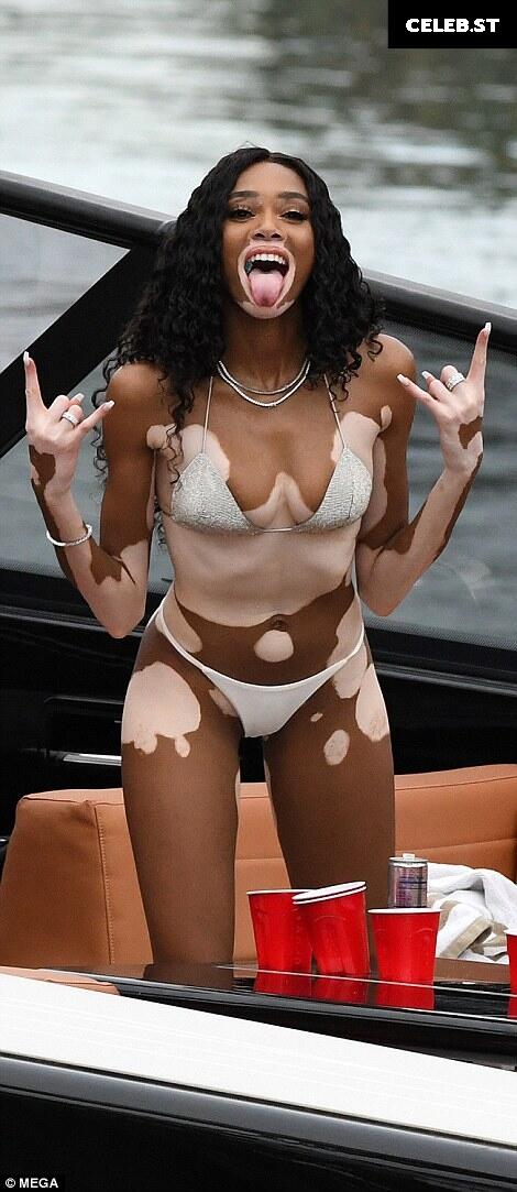 Winnie Harlow Image 1741796