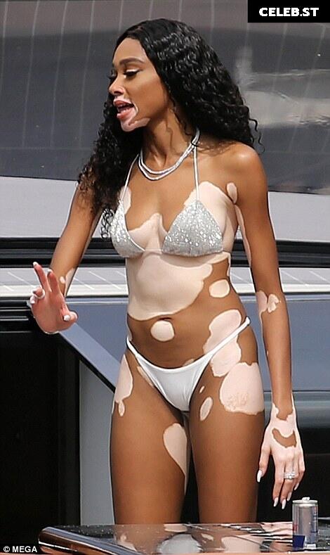 Winnie Harlow Image 1741741