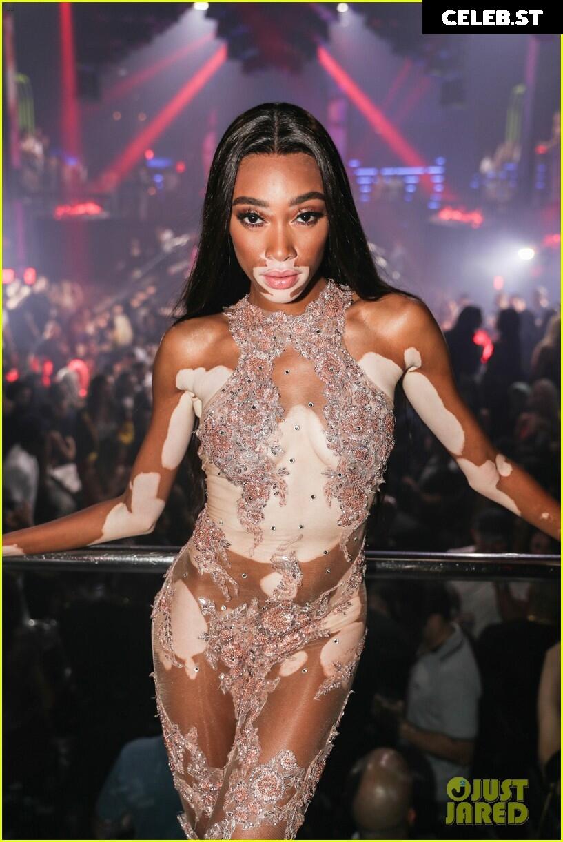 Winnie Harlow Image 1741715