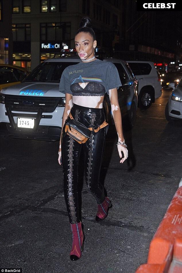 Winnie Harlow Image 1740358