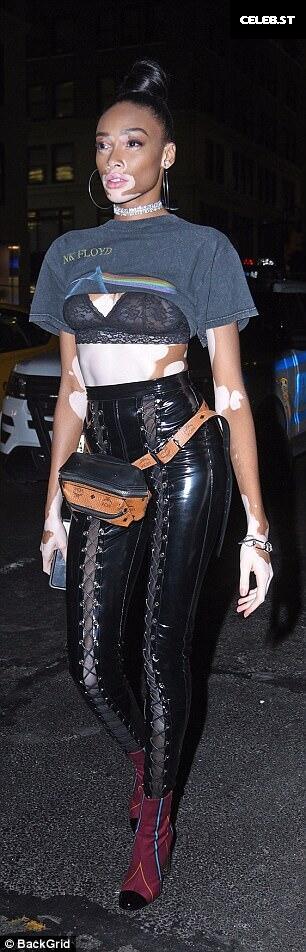 Winnie Harlow Image 1740374