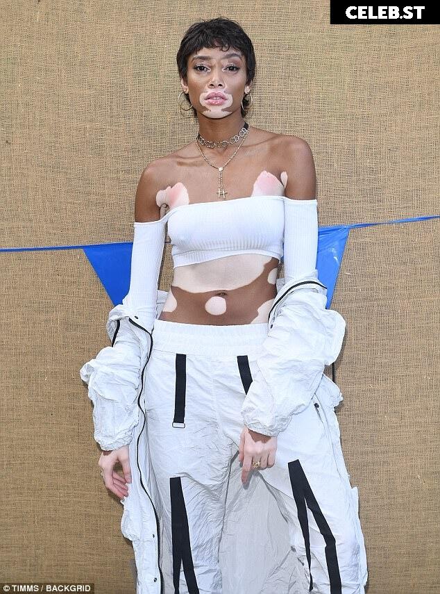 Winnie Harlow Image 1740256