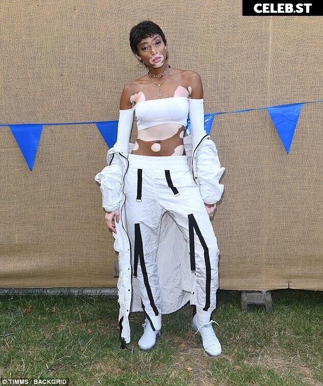 Winnie Harlow Image 1740228
