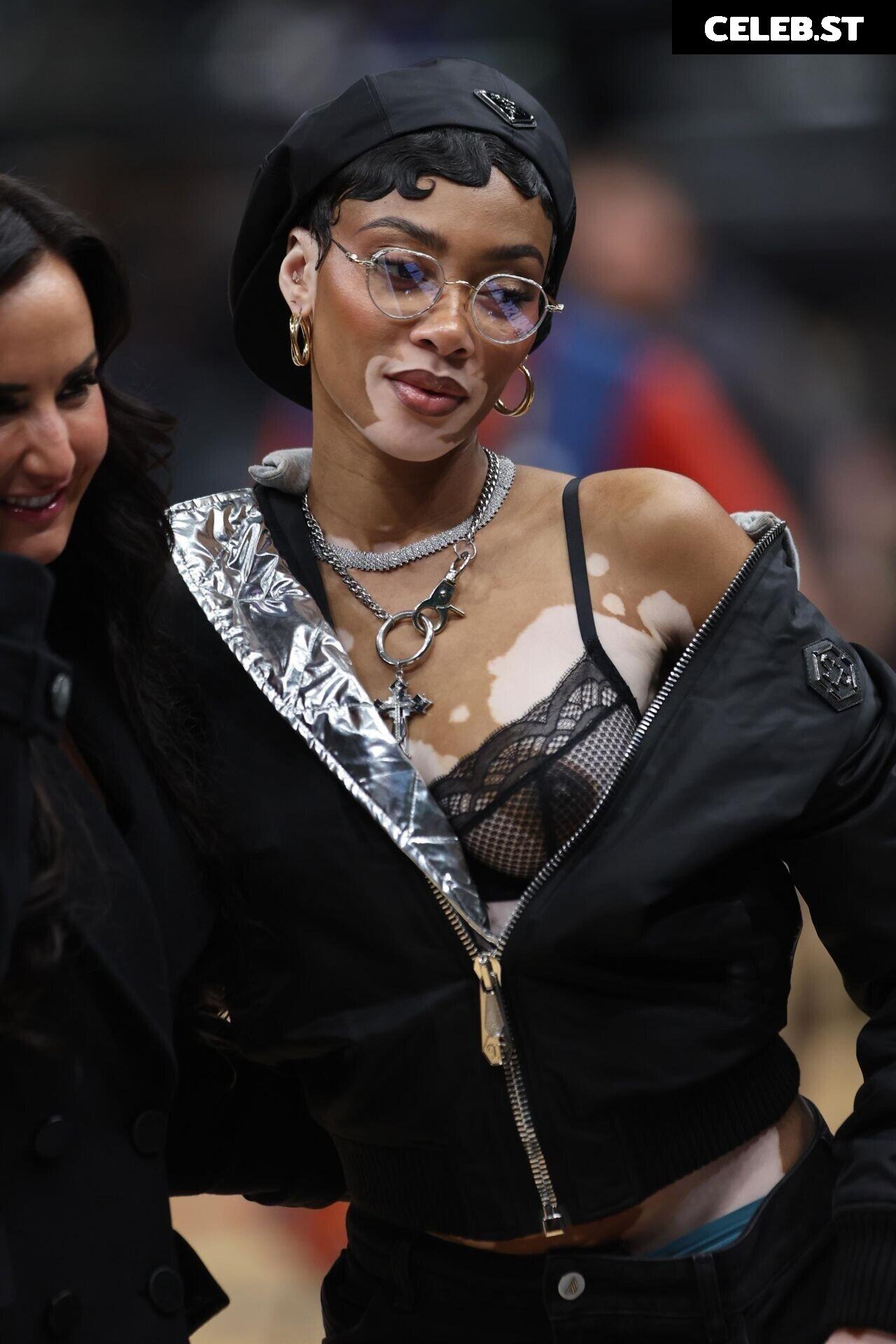 Winnie Harlow Image 1748292