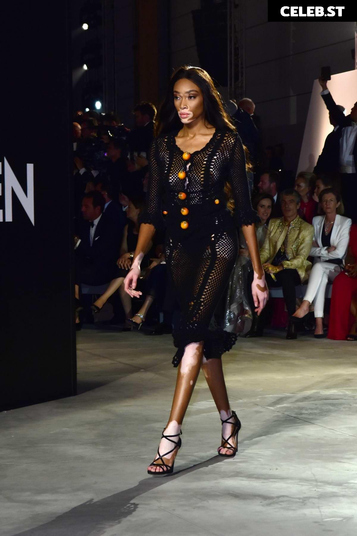 Winnie Harlow Image 1735108