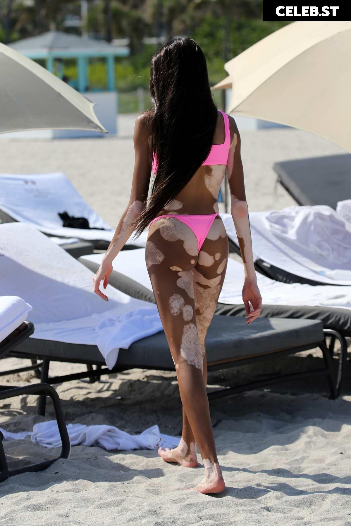 Winnie Harlow Image 1736833