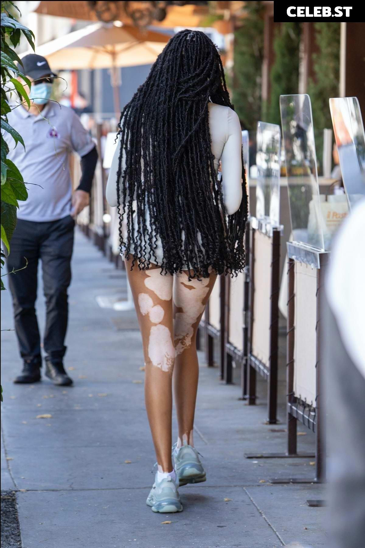 Winnie Harlow Image 1736508