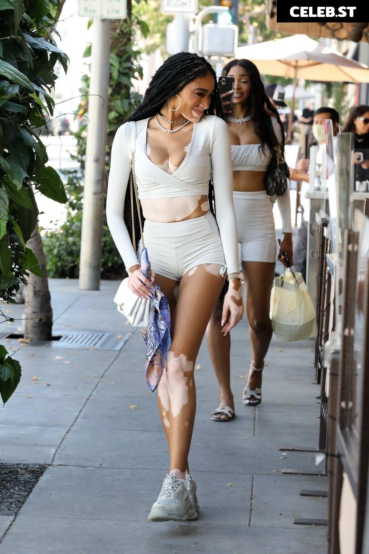 Winnie Harlow Image 1736482