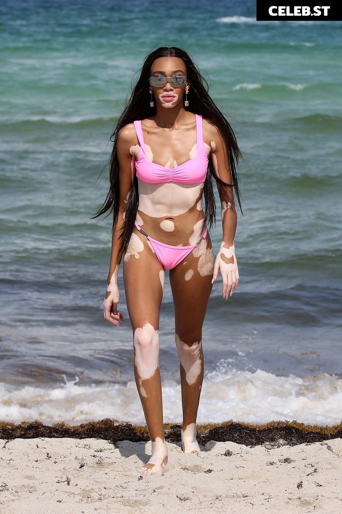Winnie Harlow Image 1736797