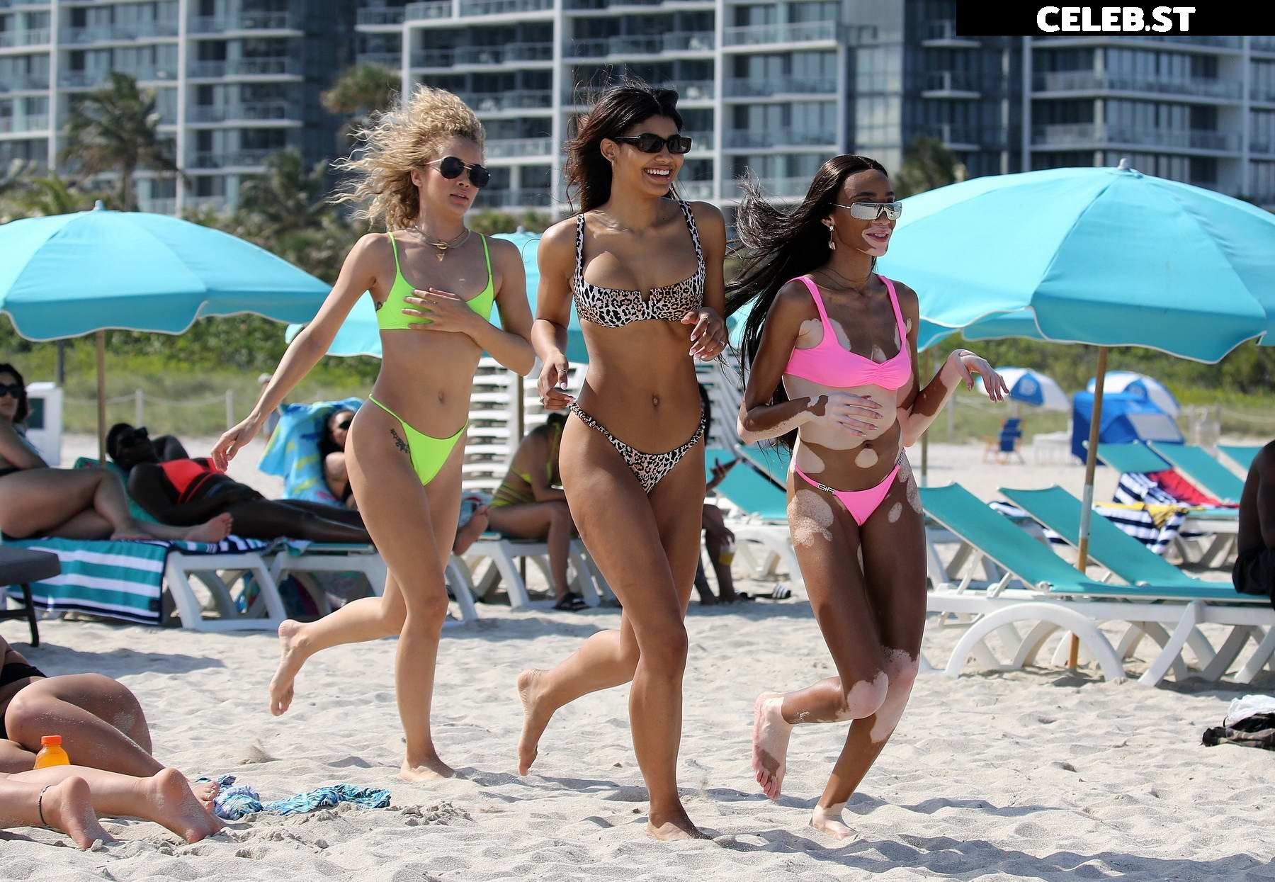 Winnie Harlow Image 1736778