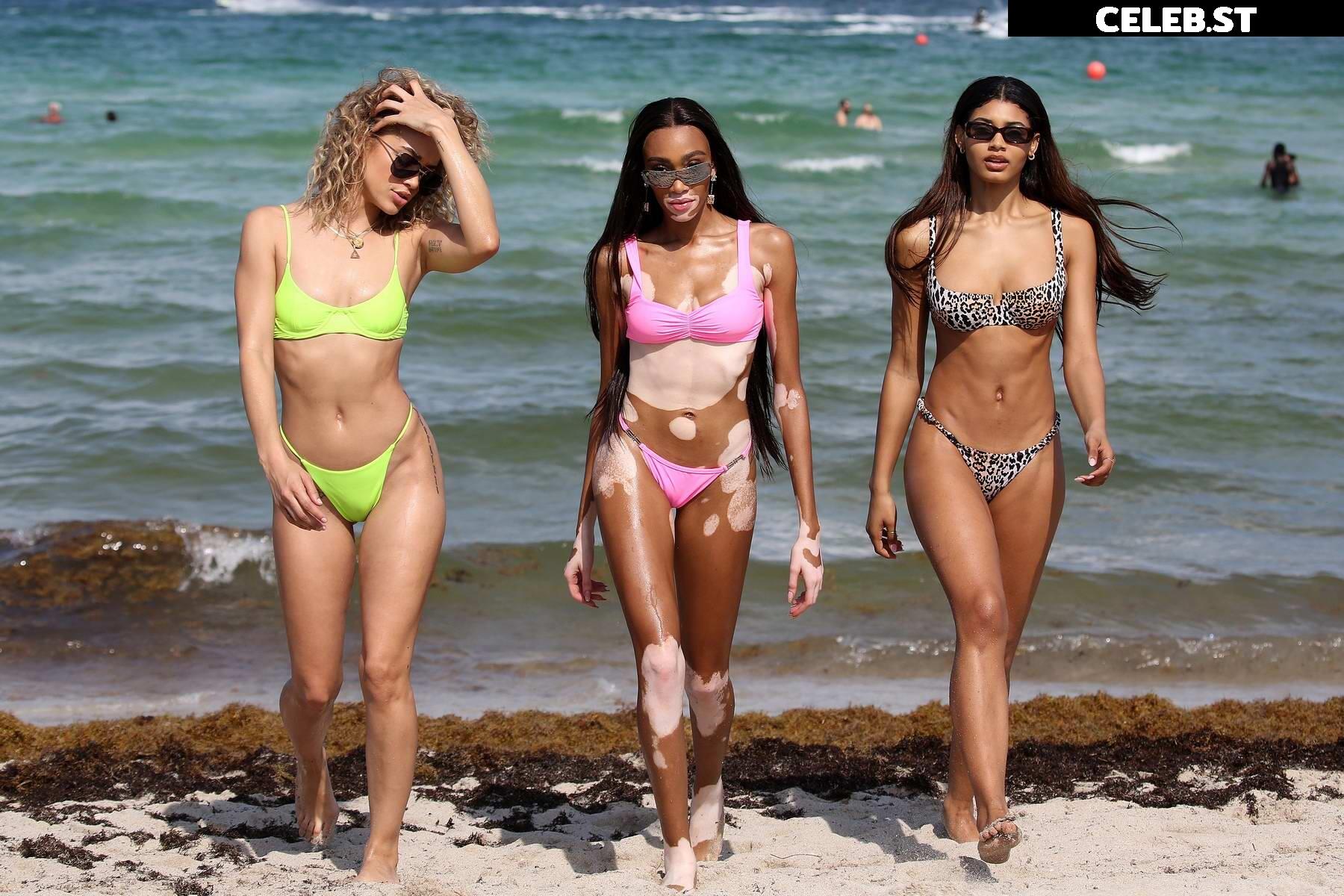 Winnie Harlow Image 1736686